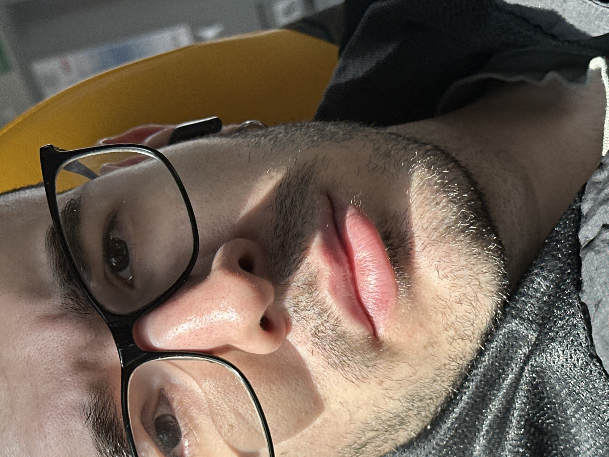 A close-up image shows a man's face, angled with his head resting on a yellow surface. He wears black-rimmed glasses. A light source casts shadows across his face. He has short facial hair. He is wearing a grey top. There is no information to suggest the location is in Moscow, Russia.