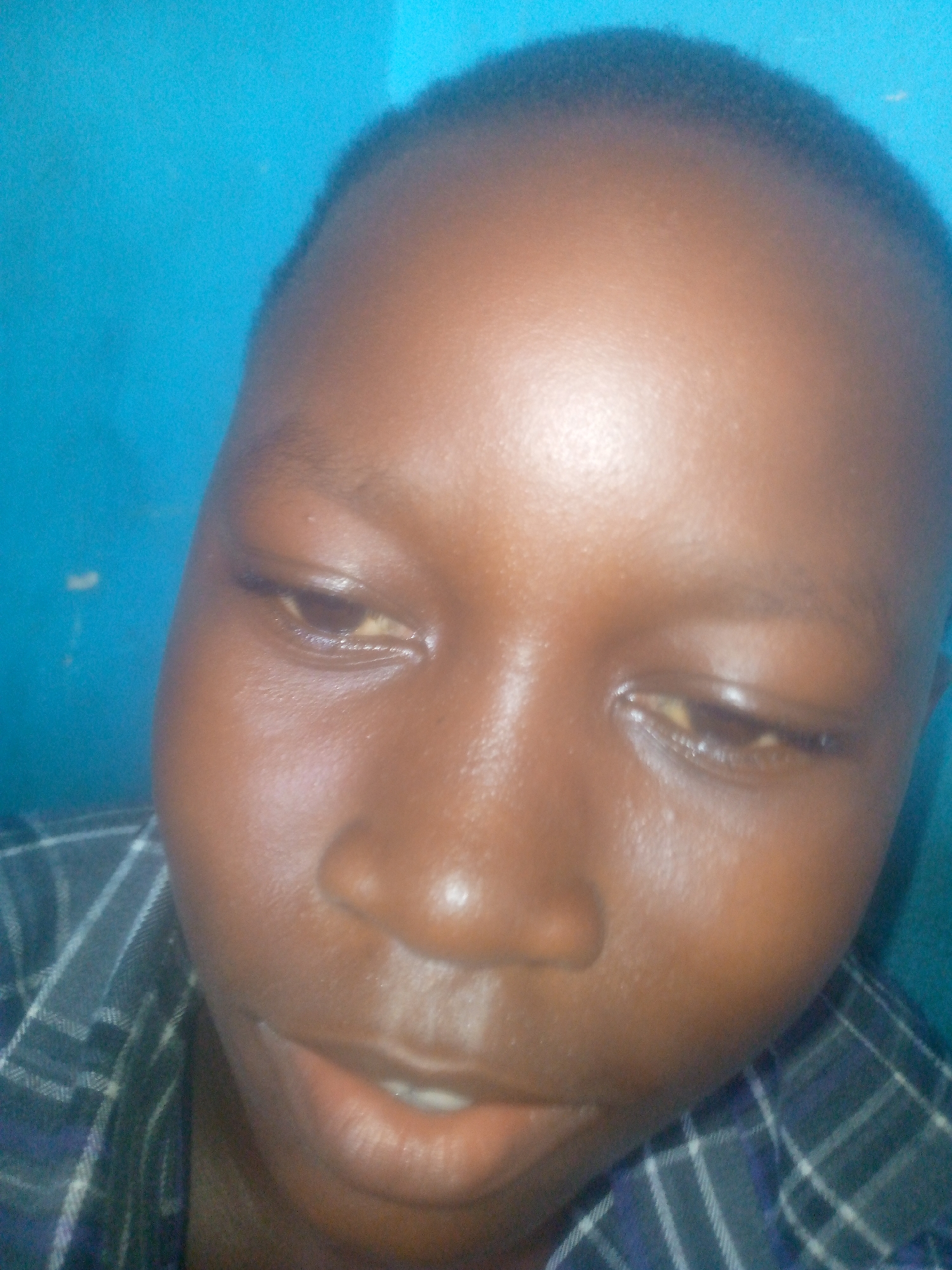 A close-up, slightly angled shot focuses on a dark-skinned individual with short, dark hair. The person is wearing a plaid shirt with dark and light lines. The background is a solid, light blue color. The setting cannot be definitively placed in Ikorodu, Nigeria, as no location-specific identifiers are present.