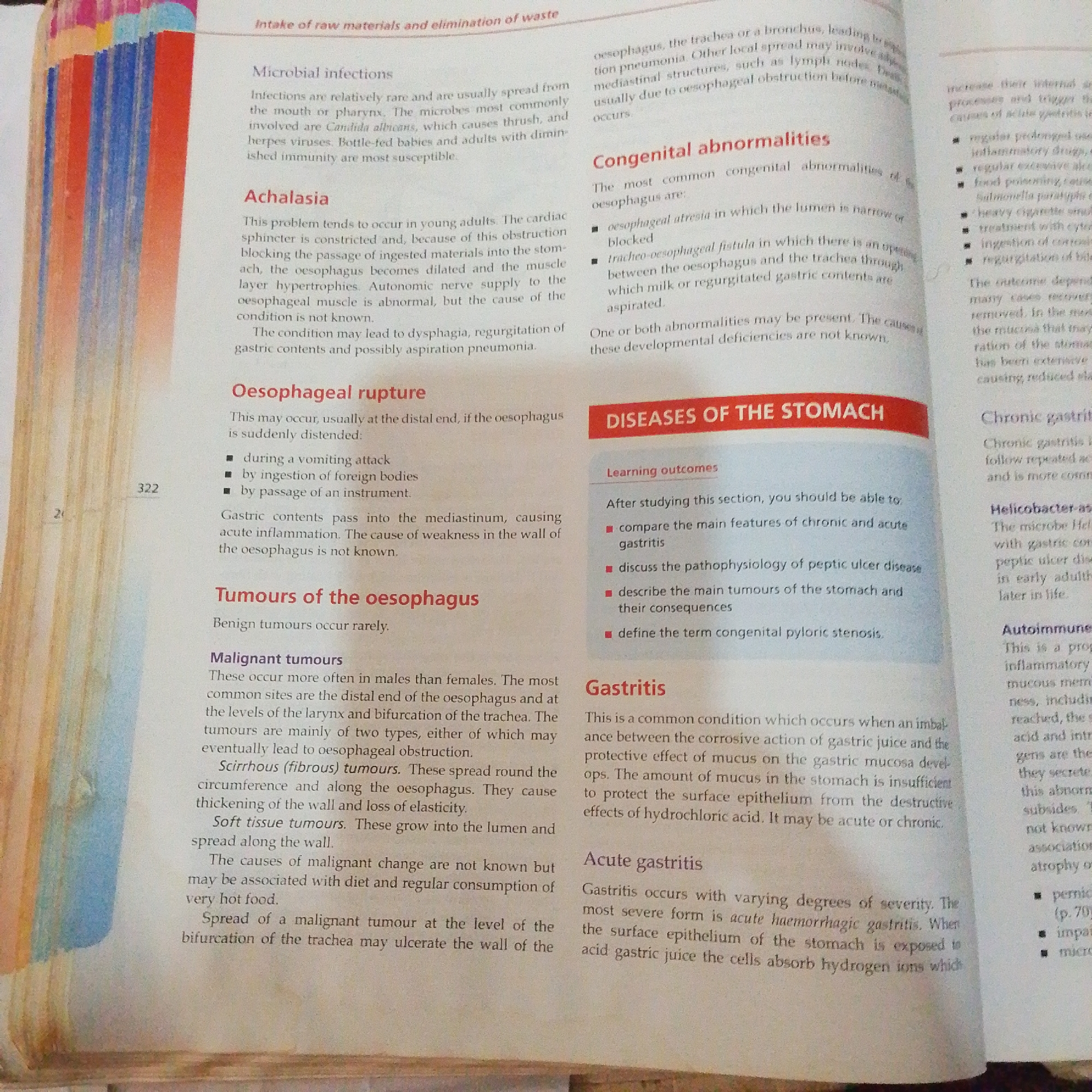 The image is a photograph of a page from a textbook, likely a biology or medical text. The text discusses diseases of the stomach and esophagus, including microbial infections, achalasia, oesophageal rupture, tumours of the oesophagus, and gastritis. The page includes headings, subheadings, and bullet points. There is also a page number "322" visible. The background is blurred and out of focus, with colors suggesting a book or binder. There is no information in the image that places it in Jalingo, Nigeria, or describes any forensic details.