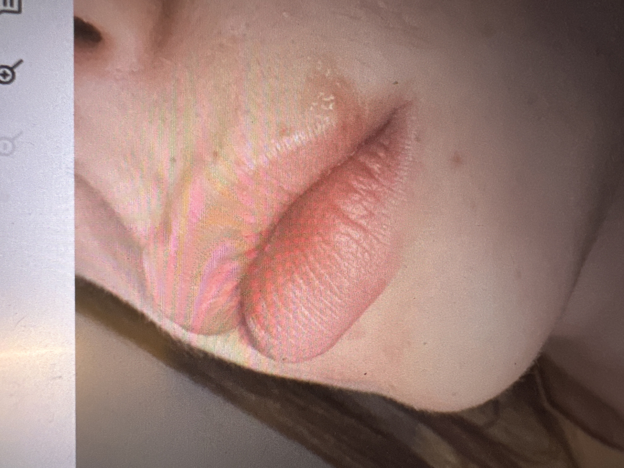 The image is a close-up, angled shot of a person's lips and surrounding skin. The lips are a reddish-pink color and appear to have vertical lines and texture. The skin is light-skinned with some subtle variations in tone and a few small dark spots. A shadow cast by an unseen object runs diagonally across the left side of the image, obscuring part of the face and hair. The background is out of focus and appears to be a bright, possibly digital, surface with some faint lines and icons visible at the top, suggesting the image may have been captured from a screen. There is no indication of the city of Murcia, Spain, in the image.