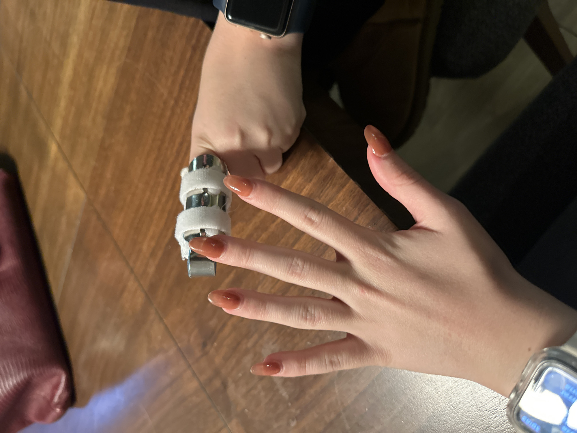 The image shows a close-up view of two hands on a wooden table. One hand, in the foreground, displays long, polished nails with a brownish-orange hue. This hand is positioned to the left, with fingers spread. The other hand, to the right, is partially visible, wearing a dark-colored smartwatch on the wrist. On the dorsal side of this wrist, a medical device is affixed, consisting of several silver cylindrical components wrapped in white material, likely a splint or brace. The background is out of focus but suggests an indoor setting with a wooden table and a dark, possibly upholstered object in the upper left corner. The scene is lit from above, creating soft shadows on the table. The image does not contain any discernible elements that would suggest a specific location in Huixquilucan de Degollado, Mexico.
