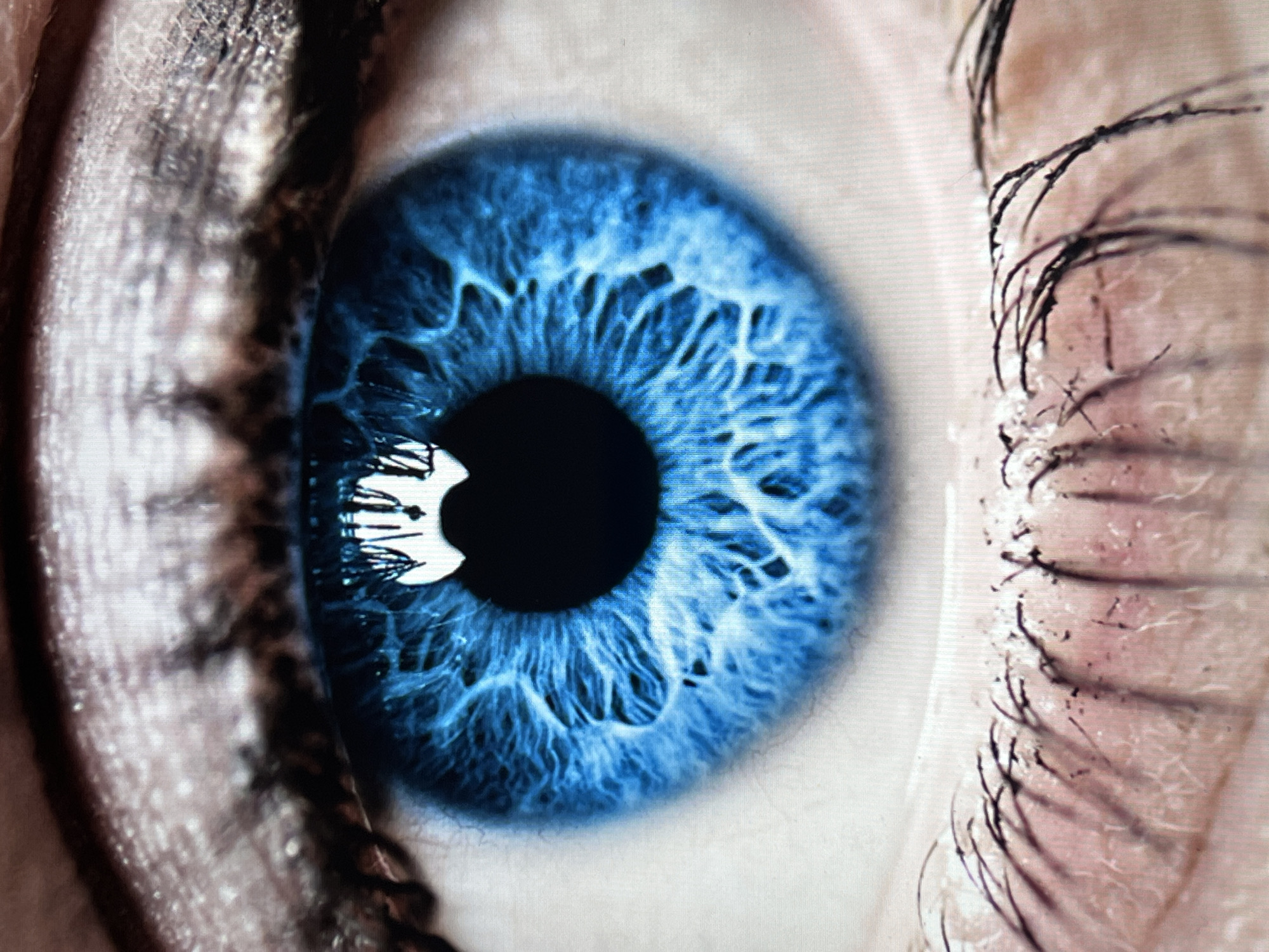 The image is a close-up of a human eye. The iris is a vibrant blue color with intricate patterns. The pupil is black with a reflection. Eyelashes are visible on both sides of the eye, with skin texture apparent near the lashes. The location is unknown.