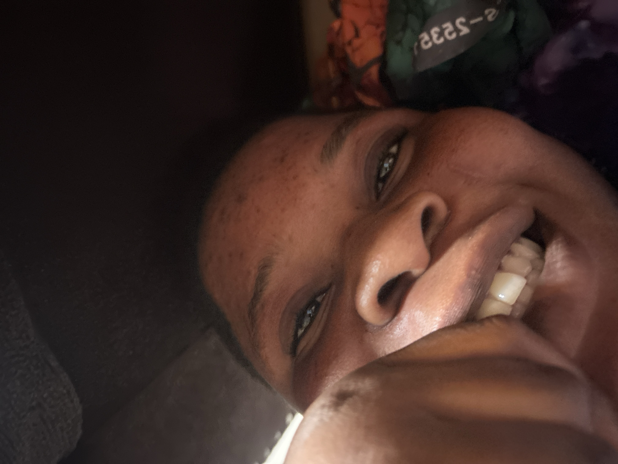 The image shows a close-up of a person's face, angled slightly towards the right. The person has dark skin, with visible freckles on their forehead. Their eyes are open, and they are smiling, revealing their teeth. Part of the person's hand is visible near their mouth. The background is dark and indistinct, with some blurred fabric and a tag visible in the upper right corner. The location is unknown.