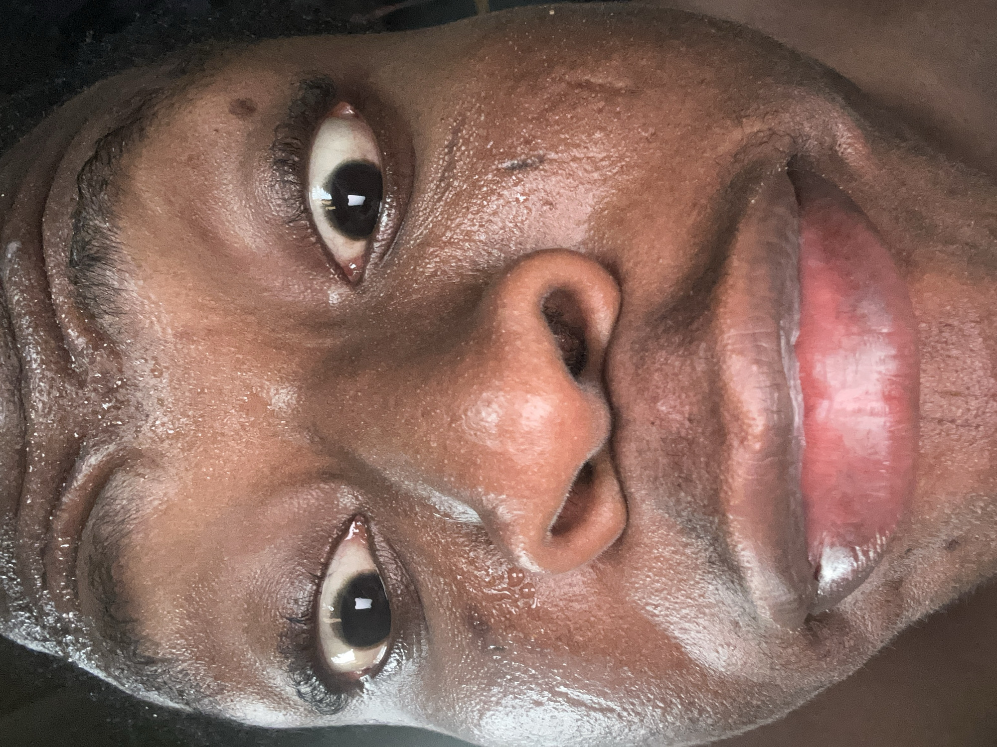 A close-up, rotated image shows a person's face. The skin is dark and appears shiny, possibly due to sweat or oil. The eyes are wide open, with the pupils clearly visible. The lips are parted, revealing the inside of the mouth. There is no specific information about the location or the city.