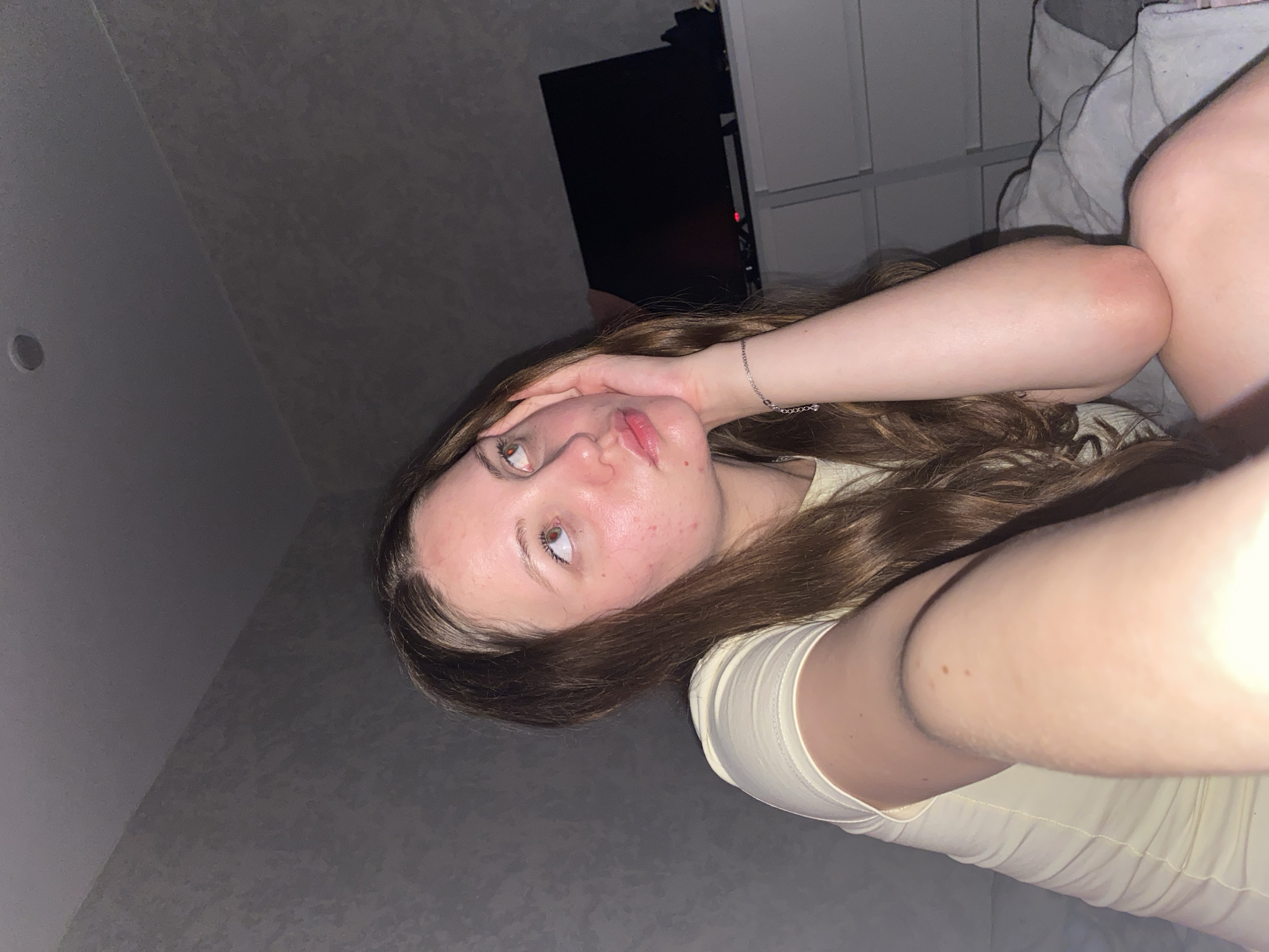 The image shows a young woman with brown hair, wearing a light yellow t-shirt, sitting in a dimly lit room. Her head is tilted back and her hand is resting on her cheek as she looks upwards. There are some red blemishes on her face. In the background, a television set is visible on top of a white dresser. The room appears to be a bedroom, with a bed in the foreground and textured wallpaper on the walls. The lighting suggests it is nighttime or the room is dark. There is no specific information in the image that places it in Izhevsk, Russia.