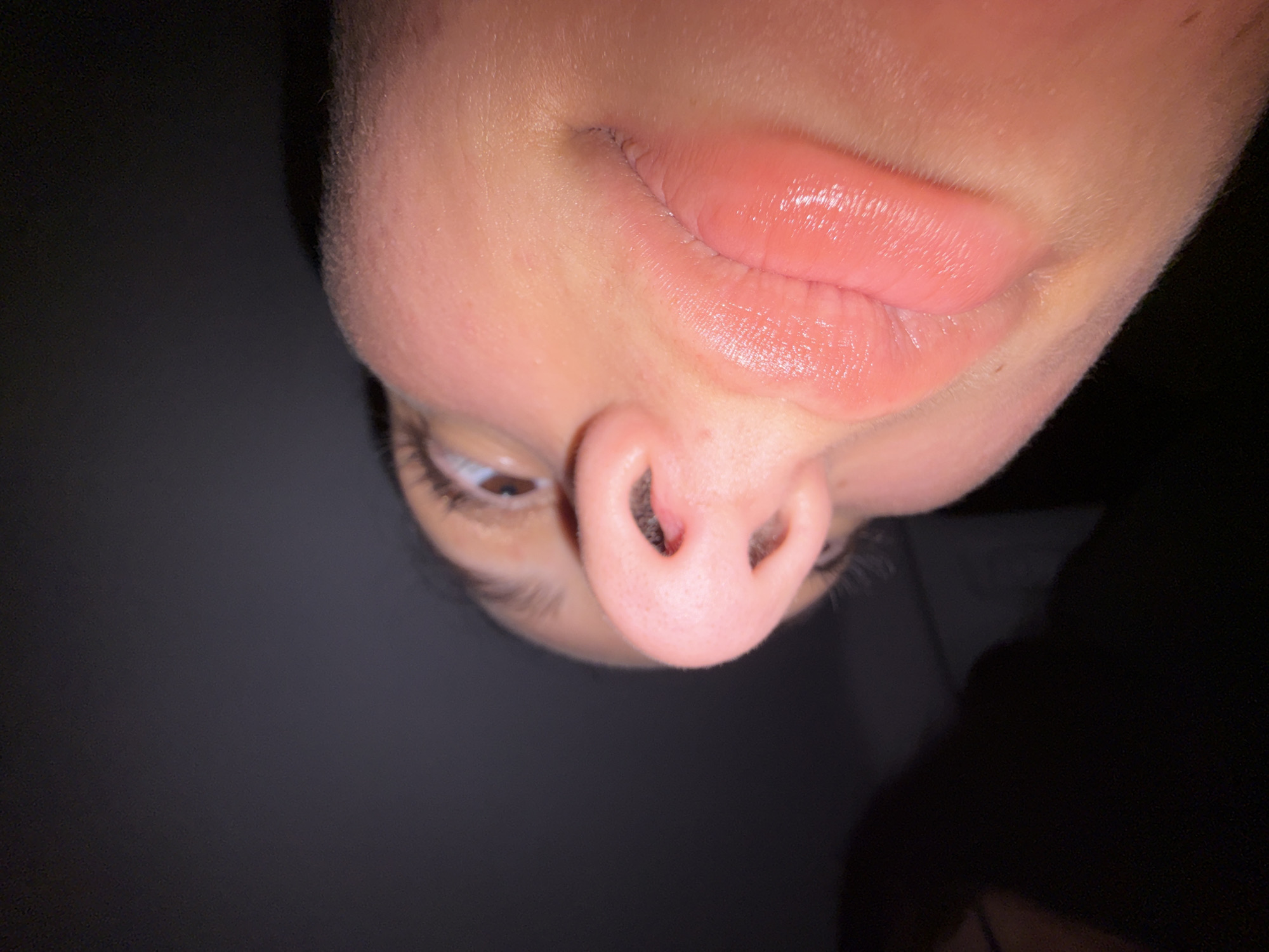 A close-up, low-angle shot focuses on the lower half of a person's face, with the nose and lips prominently featured. The background is dark, creating a stark contrast with the illuminated skin. The subject's skin appears smooth with some subtle texture. The lips are slightly parted, revealing a moist, glossy surface, and appear to be a natural pink hue. A portion of the person's eye and eyebrow are visible in the upper left quadrant of the image. The nose is positioned in the center-left of the frame, showing nostrils with a slight redness within them. The overall lighting suggests an indoor environment, possibly with artificial light directed at the face. The image does not provide any information about the city of Tsarevo, Bulgaria.