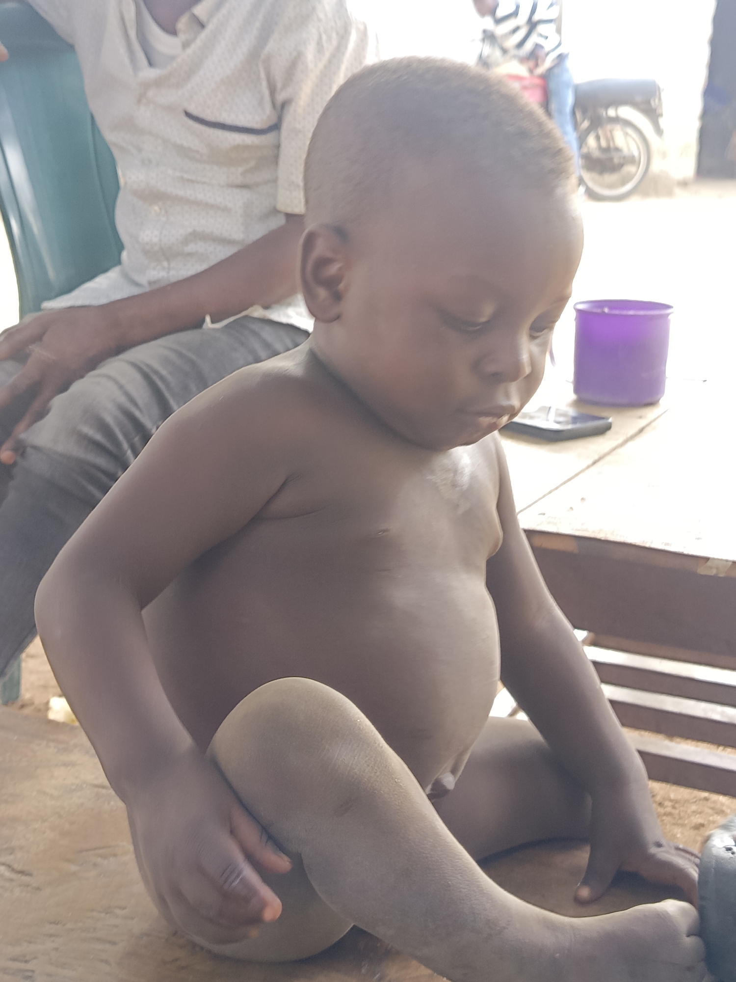 A toddler with dark skin sits shirtless on a wooden surface in what appears to be an outdoor setting. He has a slightly protruding belly. An adult in a patterned shirt and grey pants sits behind him on a green plastic chair. A purple cup and a black smartphone are visible on the wooden surface beside the toddler. In the background, a motorcycle is partially visible. The setting is Unguwar Zaria, Nigeria. The toddler appears to be looking downward.