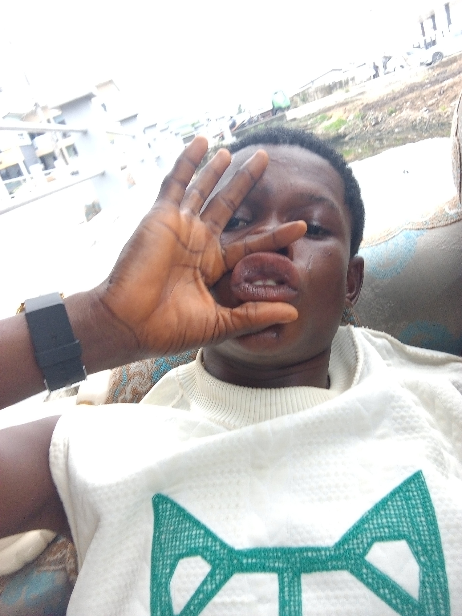 A close-up portrait features a person, likely male, with dark skin and short dark hair, captured in a candid and playful moment. The individual is making a humorous expression, using the thumb and index finger of their left hand to pinch their lips, creating a "fish-face" effect. Their eyes are visible above their hand, looking directly at the camera.
The person is wearing a white, textured sweater or top with a ribbed high collar. A distinctive green, geometric pattern, resembling a stylized bow tie or interlocking shapes, is embroidered or printed on the chest area of the sweater. On the left wrist, a black watch or wristband with a metallic (possibly gold) buckle is visible.
The background is significantly overexposed and blurred, suggesting a very bright outdoor setting during the daytime. Distant, light-colored buildings, what appears to be a body of water or wet ground, and some faint vegetation or structures can be vaguely discerned, indicative of an urban or semi-urban environment. Part of a patterned cushion or sofa upholstery is visible behind the person on the right side of the frame. The overall impression is casual and lighthearted. No visible text is present in the image.