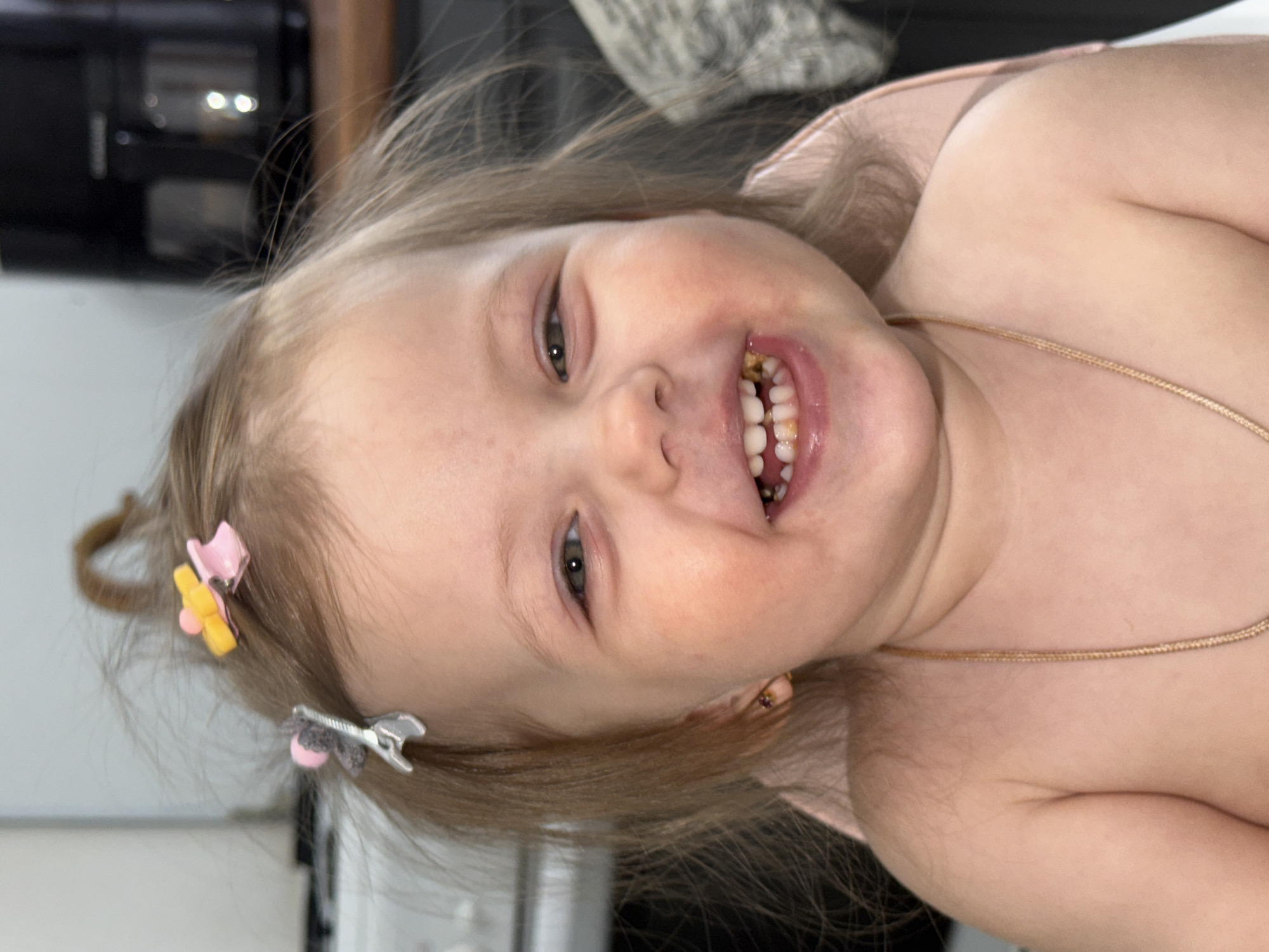 A young child with fair skin, blonde hair, and two hair clips is smiling broadly, revealing some dental discoloration. The child is wearing a thin gold necklace. The background includes a kitchen setting with blurred appliances. The location is not discernible as Reshetnikovo, Russia, from this image.