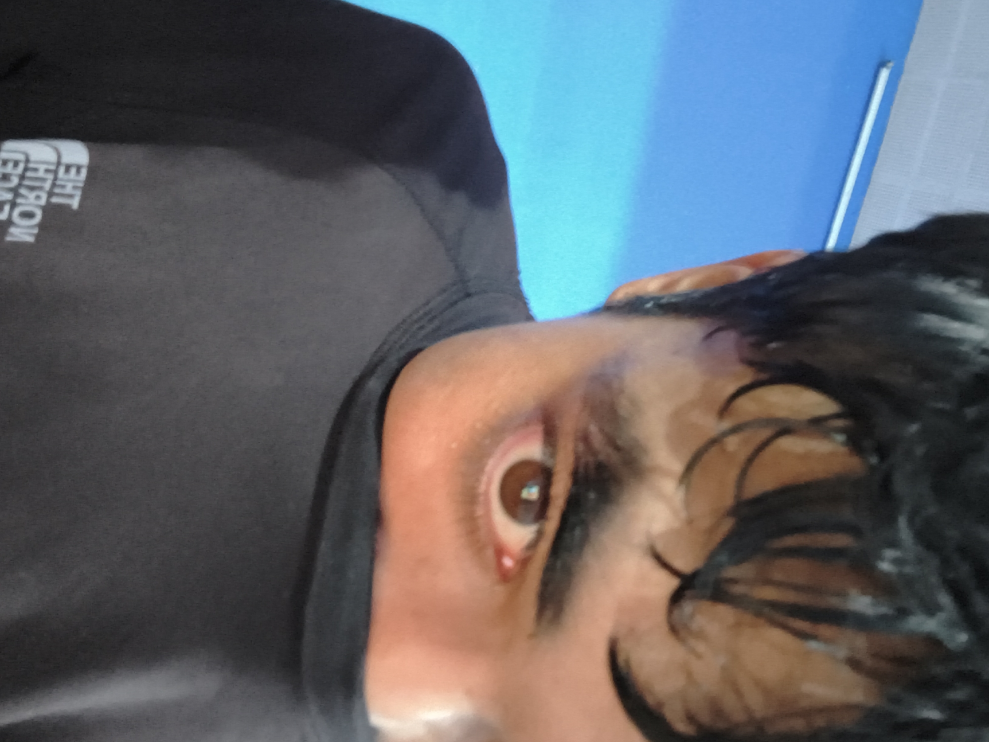 A close-up, eye-level, vertical, medium shot captures a person from the nose up, looking into the camera. The person has dark hair, a dark shirt, and a slightly red eye. The background is a bright blue wall with a white rod-like object running horizontally across it. The lighting is bright, suggesting an indoor setting. The person's face is partially obscured by a black garment. The overall scene appears to be casual.
