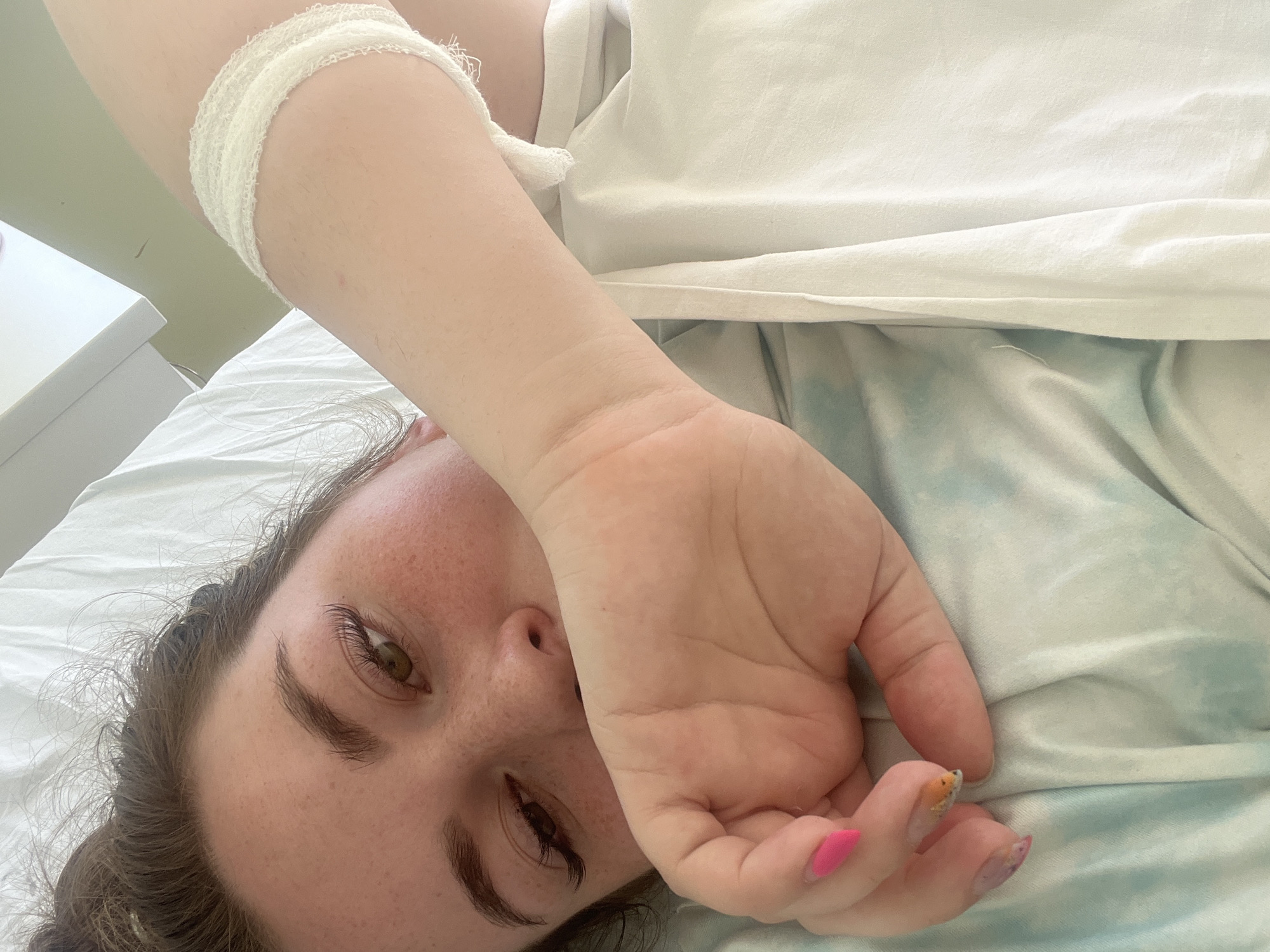 The image shows a woman lying on her side, possibly in a hospital or clinic setting. She has a white bandage wrapped around her upper arm. She is wearing a white shirt and lying on a bed with light blue and white patterned sheets. Her face is partially obscured by her hand. Her fingernails are painted, with one nail being pink and another having an orange and yellow design. The background is blurry, but a white cabinet is visible. There is no clear indication of Chaikovsky, Russia from this image.