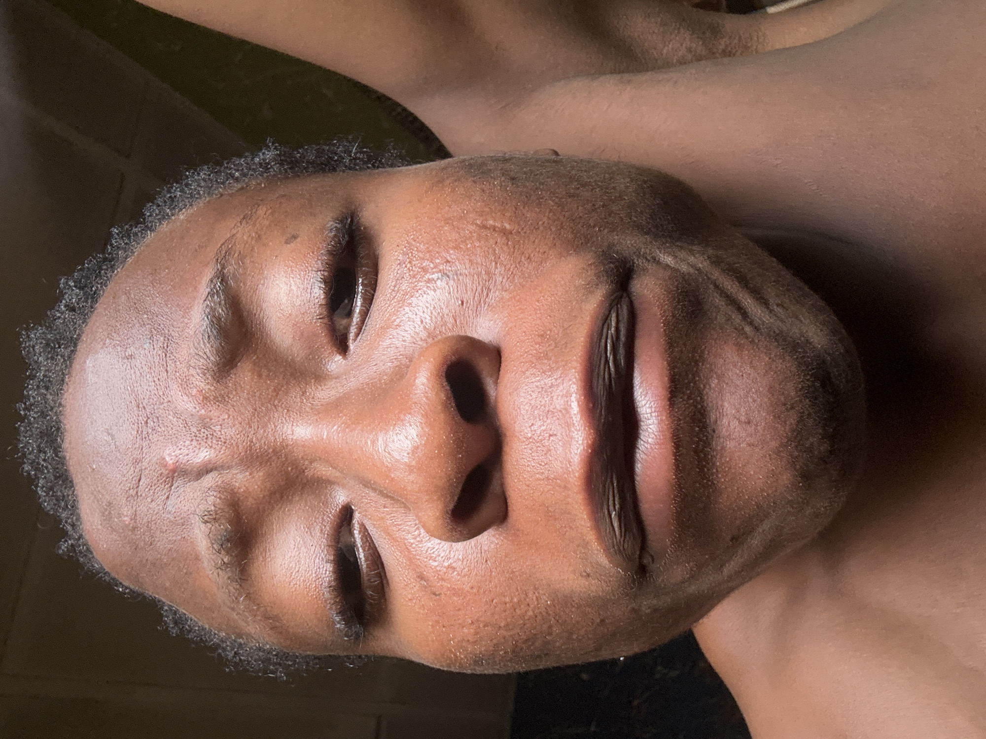A close-up, high-angle shot captures the face of a person with dark skin, oriented horizontally with their right side appearing uppermost in the frame. The subject's head occupies the majority of the image, with parts of their chest and shoulder visible in the blurry, dark background.
The person has short, tightly curled dark hair and distinct facial features. Their eyes are slightly open, looking upwards towards the camera, with visible eyelashes. The nose is prominent, and the lips are full and slightly parted. There are some visible pores and minor textural variations on the skin, including a couple of small blemishes or marks on the forehead and cheek. The skin appears somewhat dewy or reflective under the lighting.
The lighting is direct, highlighting the contours of the face and creating soft shadows, particularly around the nose and chin area. The overall mood conveyed by the expression is neutral, possibly relaxed or contemplative. The background is dark and out of focus, emphasizing the subject's face. No specific location cues or text are visible in the image.