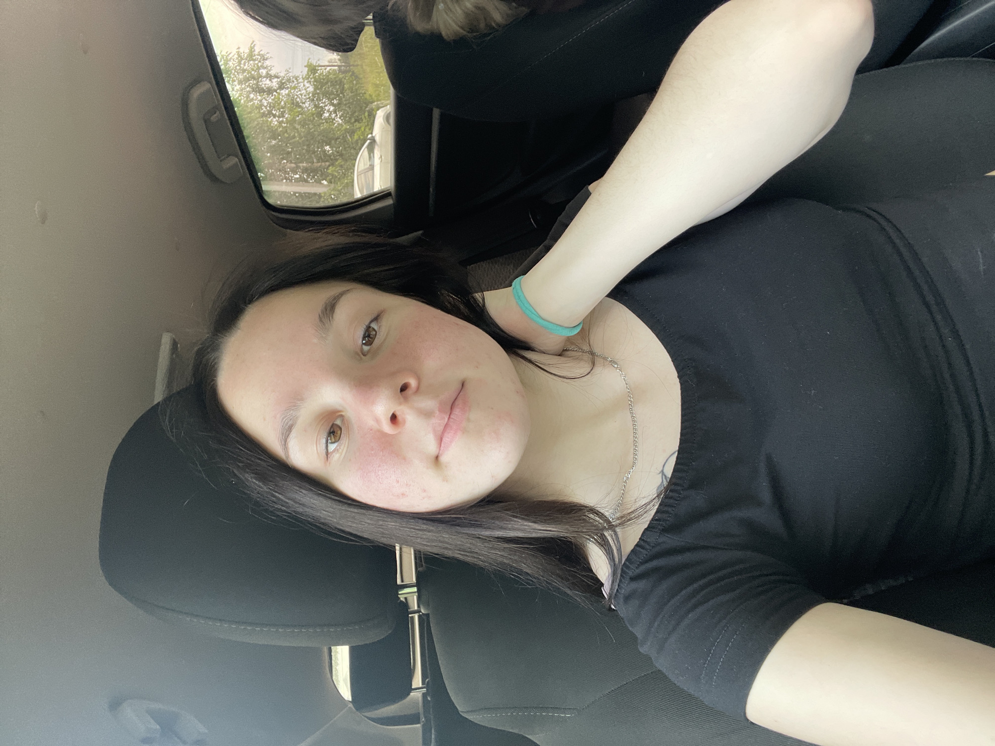 This is a selfie taken by a young woman inside a vehicle. She has long, dark hair and brown eyes, and appears to be looking at the camera with a neutral expression. Her skin shows some redness, particularly on her cheeks. She is wearing a black top and a silver necklace, and a light blue bracelet on her left wrist. Her right arm is extended, and part of her forearm is visible.
The background suggests the interior of a car, with car seats and a window visible. Through the window, trees and foliage can be seen, indicating an outdoor setting, likely during the day. The lighting suggests it is daytime, and the view out the window suggests it is not raining. There is no visible text in the image. The overall scene appears casual, possibly indicating the woman is a passenger in the car or taking a break during a car journey.