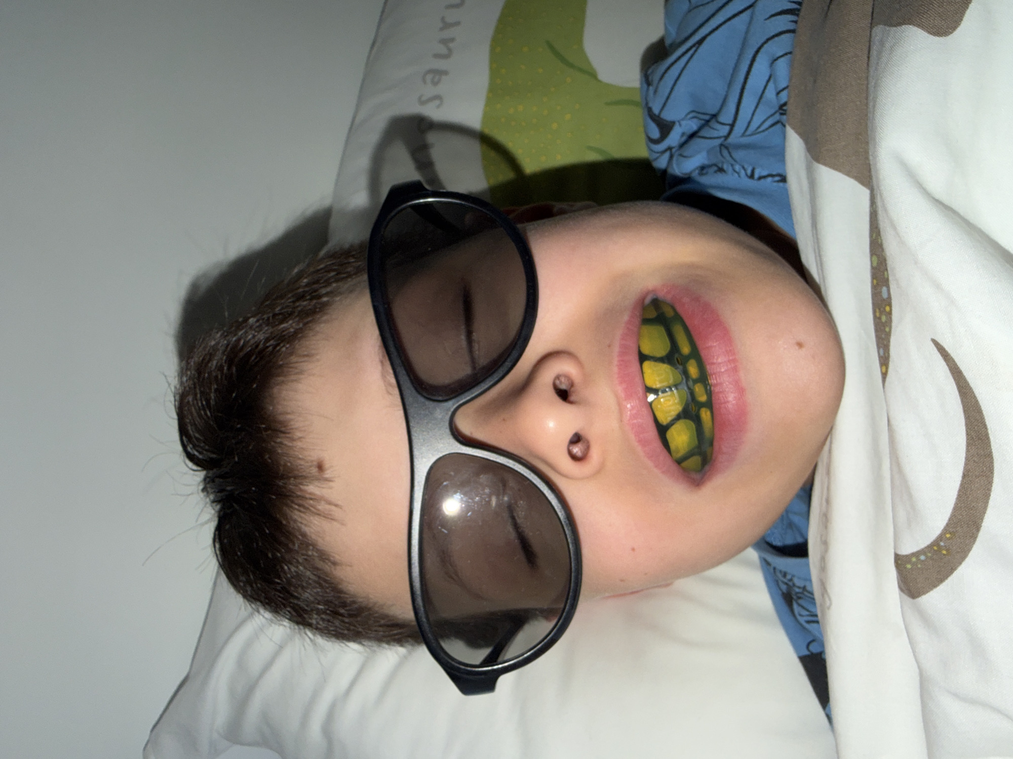 In an indoor setting, likely a bedroom in Votkinsk, Russia, a young child is depicted lying down, resting their head on a pillow. The image is oriented vertically, with the child's head at the bottom.
The child wears dark, rectangular sunglasses that cover their eyes. Their mouth is open, revealing a prominent, bright yellow mouthguard or retainer with a black, scaly pattern, reminiscent of reptile skin. The child has short, dark hair.
They are resting on a white pillow adorned with a green background and a lighter green dotted pattern. Part of a word, "sauru," is visible in white text on the pillow, suggesting a word like "dinosaur" or "saurus." The child is partially covered by a duvet or blanket that is predominantly white with brown and possibly other patterned details. A blue garment, likely a pajama top or shirt with dark patterns, is visible beneath the blanket.
The scene appears to capture a playful or relaxed moment, possibly during rest or imaginative play, rather than actual sleep, given the presence of the sunglasses and stylized mouthguard. The lighting is soft and consistent with indoor conditions.