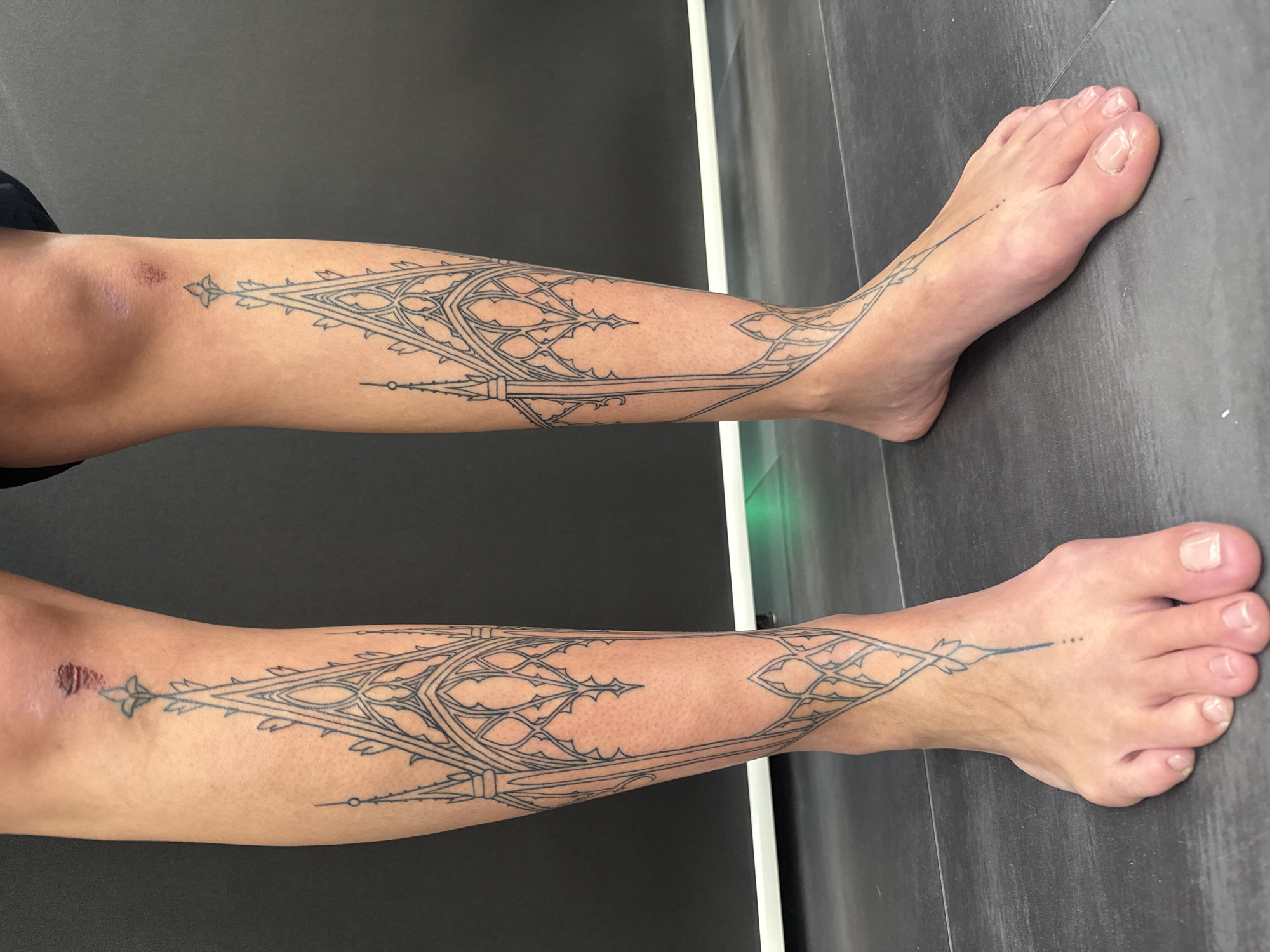 Two legs, likely belonging to the same individual, are presented vertically against a dark background, showcasing identical intricate tattoos. The person's skin tone is light brown.
The main subjects are the two lower legs, each adorned with a detailed, architectural-style tattoo that resembles gothic tracery or stained-glass window patterns. The tattoos are rendered in fine black lines, extending from just below the knee down to the top of the foot on both legs. The design features sharp points and delicate interwoven lines, creating a symmetrical and ornate pattern. The tattoos appear to be fresh or recently completed, as suggested by the crisp lines and possible slight redness around the design.
On the upper calf/knee area of both legs, there are small, reddish abrasions or scabs, suggesting a minor injury or healing process. The feet are visible, with natural, unpolished toenails.
The activity depicted is a display of new or recently acquired tattoos. The legs are extended, suggesting the person is lying down or sitting.
The setting features a dark grey or black tiled floor beneath the legs and a dark grey or black wall in the background. A thin, vertical white strip, possibly an edge or frame, runs along the right side of the image, reflecting a faint green light in some sections. The lighting is bright and even, indicating an indoor environment, possibly a studio or modern room in Sofia, Bulgaria.
No visible text is present in the image.