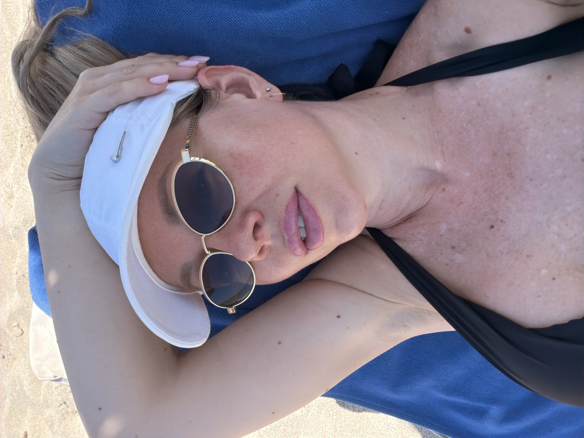 This is a close-up, overhead shot of a person lying on a blue towel on a sandy surface, likely a beach given the sand and the blue towel. The person is wearing a white baseball cap, sunglasses with gold frames, and a black bikini top. They have light-colored skin with some freckles and areas of lighter pigmentation, possibly vitiligo. Their hand, with light pink nail polish, is resting on the brim of the cap. The lighting suggests it is daytime, likely sunny. The person's face is partially visible, with their lips slightly parted and their eyes obscured by the sunglasses. The overall mood appears relaxed and summery, consistent with a beach setting. No visible text is present in the image.