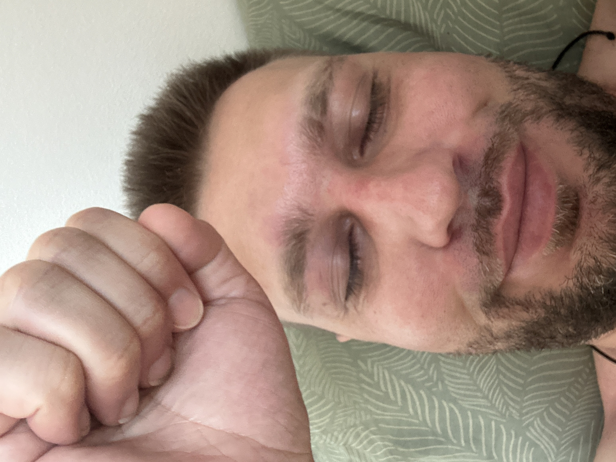 The image is a close-up, low-angle shot of a person lying down, with their head and a clenched fist in the foreground. The person has short brown hair, light-colored eyebrows, and closed eyelids. Their skin appears flushed, particularly on the forehead and cheeks. A beard is visible on the lower face. The person is lying on a pillow with a green, patterned fabric. The background is a plain, light-colored surface, likely a wall or ceiling. The context of Zvezdara Urban Municipality, Serbia, is not visually apparent in the image.