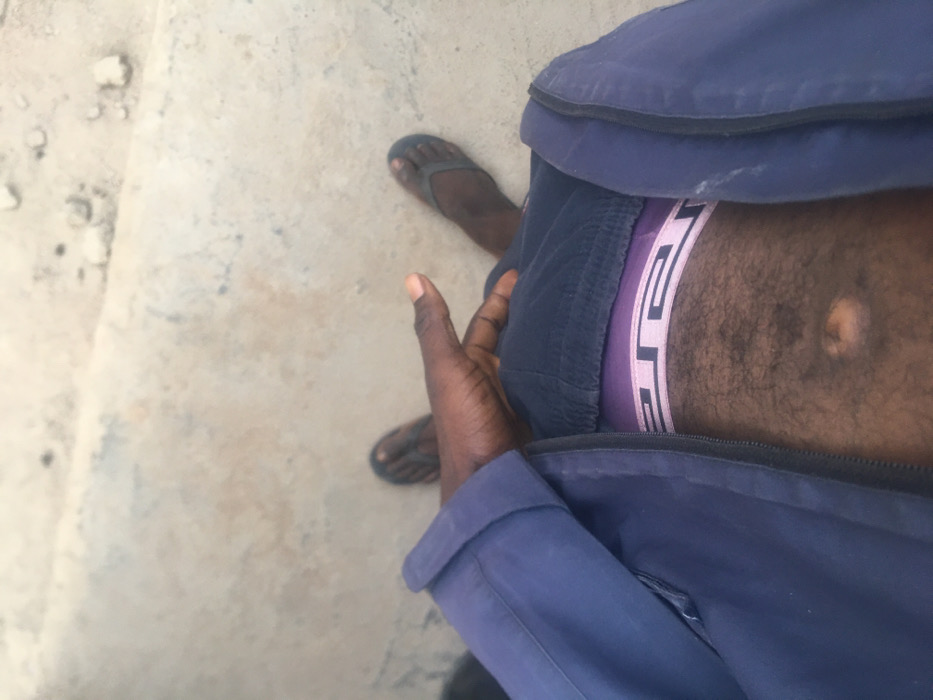 An overhead shot shows a person wearing blue clothes and sandals. A dark-skinned hand rests near the person's side. The person's stomach is visible, showing a hairy abdomen and a purple waistband of underwear. The ground appears to be a light-colored concrete surface with some debris or small rocks scattered about.