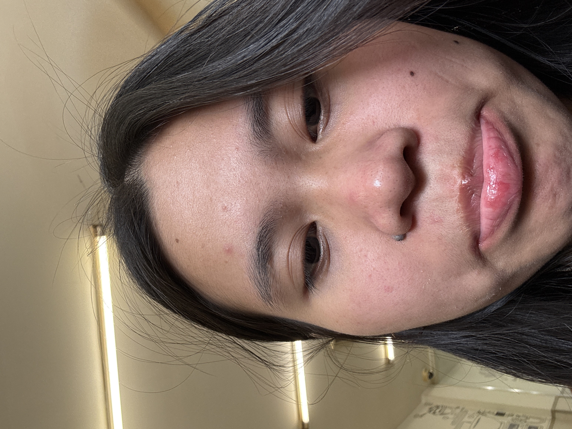 A close-up, low-angle, indoor shot shows the lower half of a young East Asian woman's face. Her dark hair frames her face, and a fluorescent light fixture is visible above and behind her. The woman has a mole on her nose, and her lips appear chapped and red, with what looks like a cold sore on her lower lip. There are also a few small pimples on her forehead and cheek. The background is blurry but appears to be a public restroom with tiled walls and a security camera. The overall impression is one of candidness, perhaps taken in a moment of discomfort.