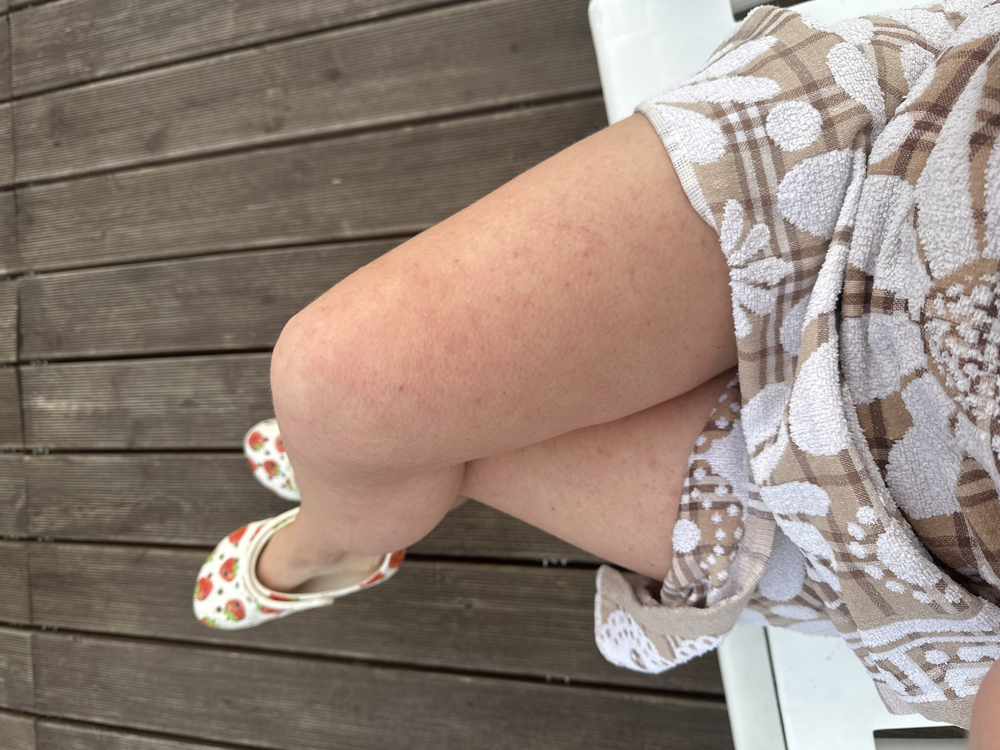 The image shows a close-up view of a person's legs, with their feet resting on a wooden deck. The person is wearing white slip-on shoes with a strawberry pattern. Their legs are crossed, and a towel with a floral and plaid pattern is draped over their lower body. The background is a wooden deck, and the lighting suggests it is daytime. The location is Yuzhnyye Koryaki, Russia.