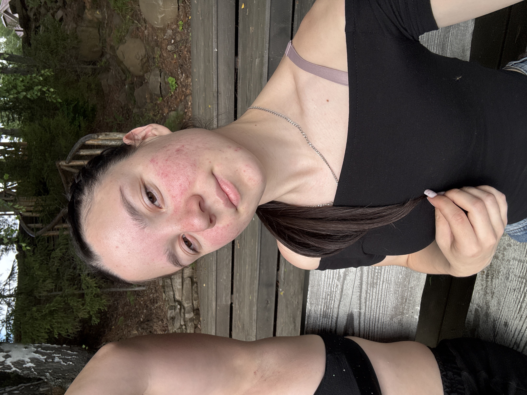 A young woman with dark hair pulled back in a braid is seated on a wooden bench outdoors. She is wearing a black off-the-shoulder top and denim shorts. Her face is flushed and appears to have some redness or irritation on her cheeks. A silver chain necklace is visible around her neck. To her left, a portion of another person's torso is visible, wearing black shorts. The background consists of a wooden structure, trees, and rocks, suggesting a natural, possibly rural setting. The image appears to be a selfie taken at a slight upward angle. The location is identified as Pozdyshki, Russia.