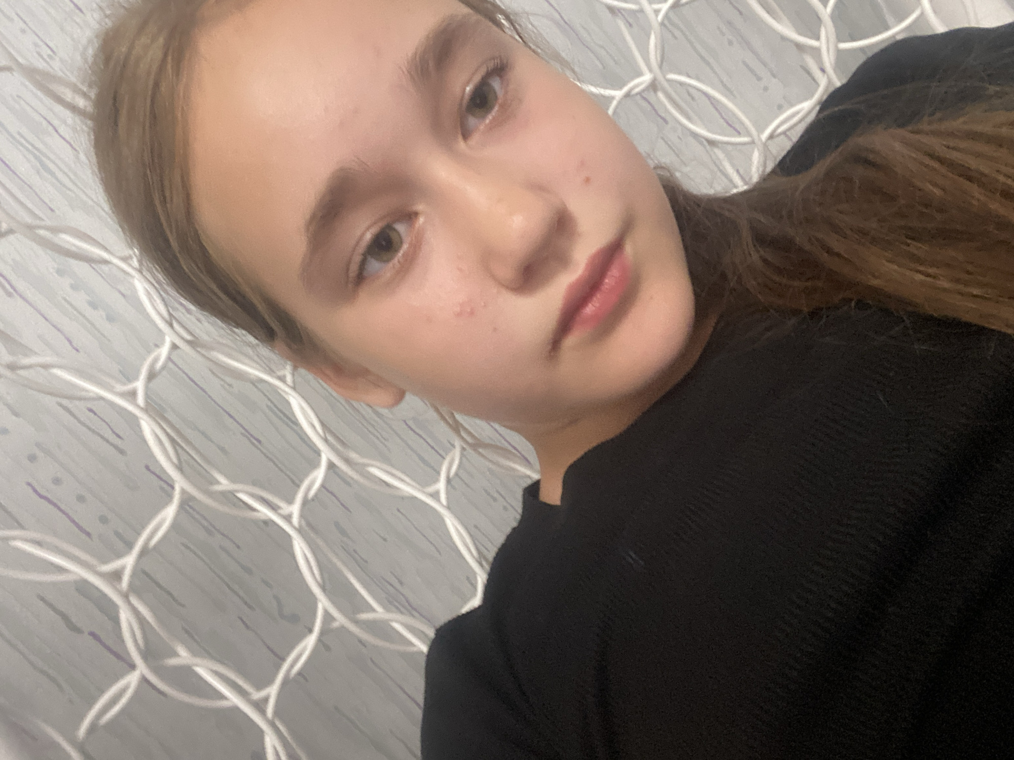 A young girl with blonde hair and light brown eyes is shown in a close-up portrait. She is wearing a black, long-sleeved shirt. Her skin has some redness and blemishes on her cheeks. The background consists of a light-colored, textured surface with a white, woven pattern. There are faint purple and grey streaks on the textured surface. The image appears to have been taken indoors, possibly in a residential setting in the city of Vysoki, Russia.