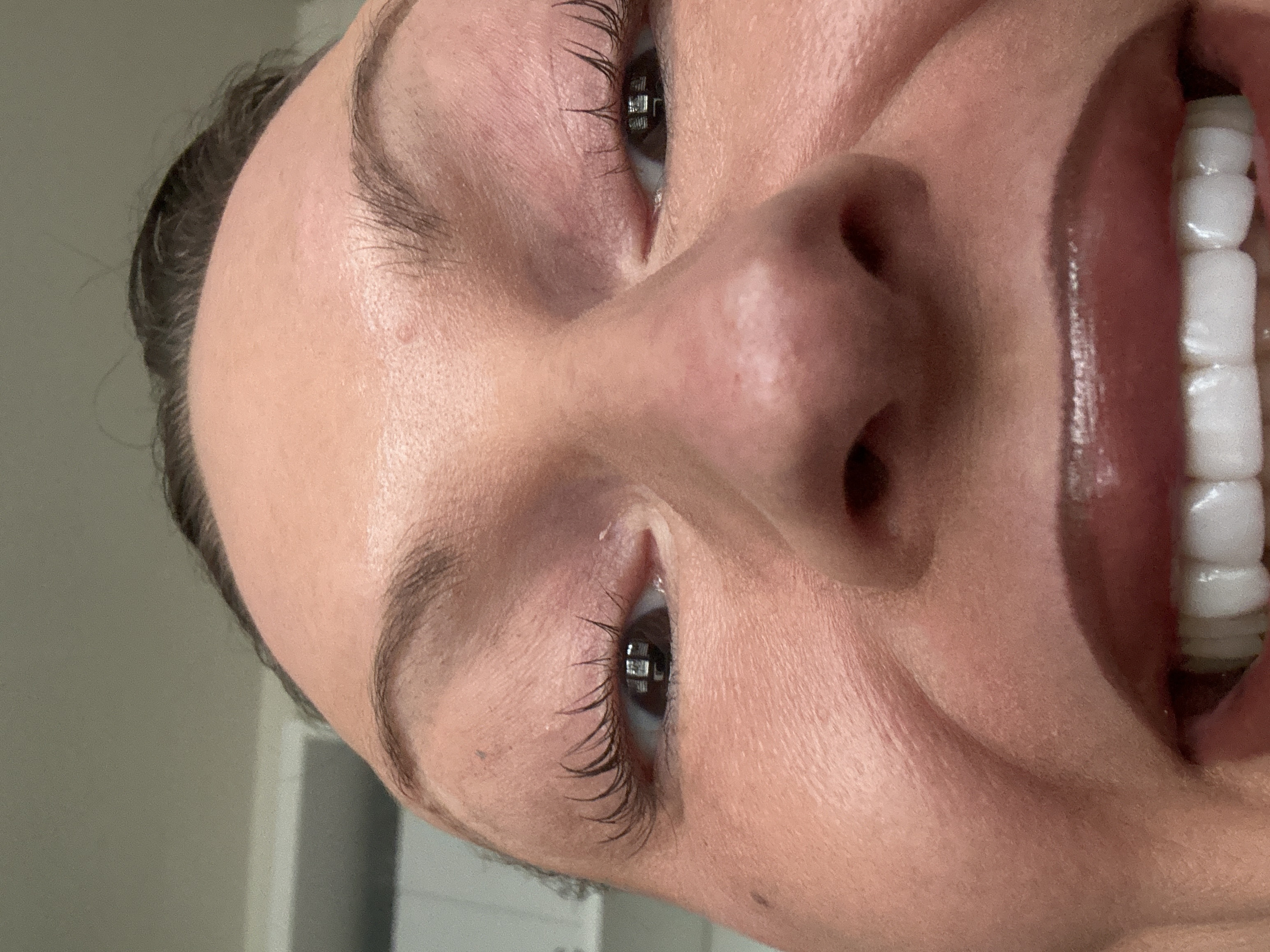 A close-up, wide-angle photographic portrait depicts the upper portion of an individual's face from a low perspective, looking upwards. The subject's skin tone is light to medium. Dark hair is visible along the top of the forehead. Both eyes are open, with dark irises reflecting a rectangular light source, possibly a window. Eyelashes are long and appear styled, and a light pink eyeshadow is visible on the eyelids. Dark, arched eyebrows are present. The nose is prominent and centered. The subject is smiling broadly, revealing a full set of uniform, white upper and lower teeth. The lips are glossy and appear to have a dark red or plum-colored application. The background is an out-of-focus, light-colored indoor wall or ceiling. No specific identifiers for the city of Wealden, United Kingdom, are present within the image.
