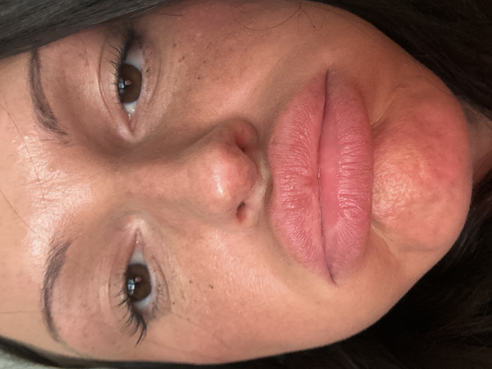 A close-up portrait of a woman's face, angled slightly to the left. She has brown eyes, dark hair visible around the edges of the frame, and noticeable freckles on her face. Her lips are full and appear to be enhanced or swollen. The skin tone is fair with a slight redness, especially around the lips. There is no information in the image to indicate its location in Tunbridge Wells, United Kingdom.