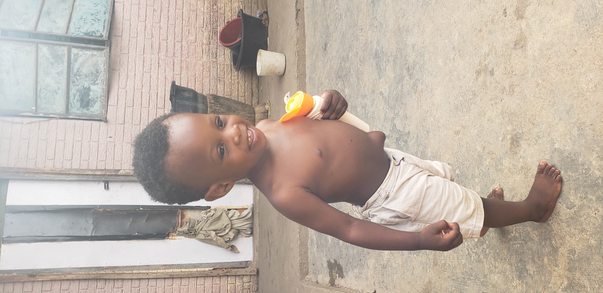 A young boy stands outdoors in Narayi, Nigeria, holding a yellow and white plastic toy. The boy, who appears to be between two and three years old, is shirtless and wearing light-colored, striped shorts. His body exhibits an abdominal hernia. He has dark, short, curly hair and is looking to his right with a slight smile. The background features a brick wall, a weathered white door with vertical panels, and several plastic containers. The ground is paved with concrete.