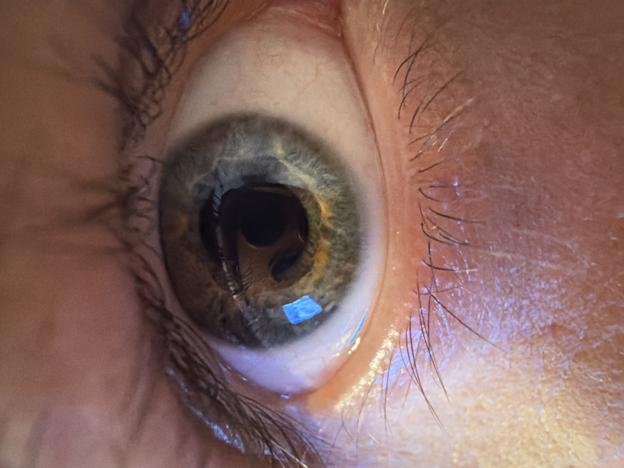 This is a close-up, macro photograph of a human eye, likely taken indoors under artificial lighting, as evidenced by the distinct blue reflections visible on the sclera and in the iris. The eye is open, with the pupil clearly dilated. The iris exhibits a heterochromatic pattern, displaying shades of blue, green, and yellow. Eyelashes are visible on both the upper and lower eyelids, some appearing slightly wet. The skin surrounding the eye shows texture and fine wrinkles. There is no information in the image to indicate the location within Bangkok, Thailand, or any specific actions or interactions occurring.