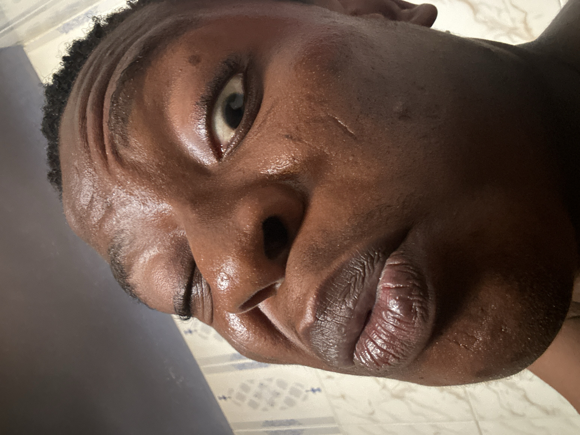 A close-up image of a dark-skinned person's face is presented, with the head tilted to the left. The subject has visible wrinkles on the forehead and around the eyes, suggesting some age or exertion. There is a small scar on the cheek near the eye. The skin appears shiny, possibly due to sweat or oil. The person's lips are slightly parted. The location is unknown, and no further details about the city are provided. The background is out of focus and indistinct, with some suggestion of a wall or tiled surface. No other people, subjects, objects, actions, or interactions are evident in the frame.