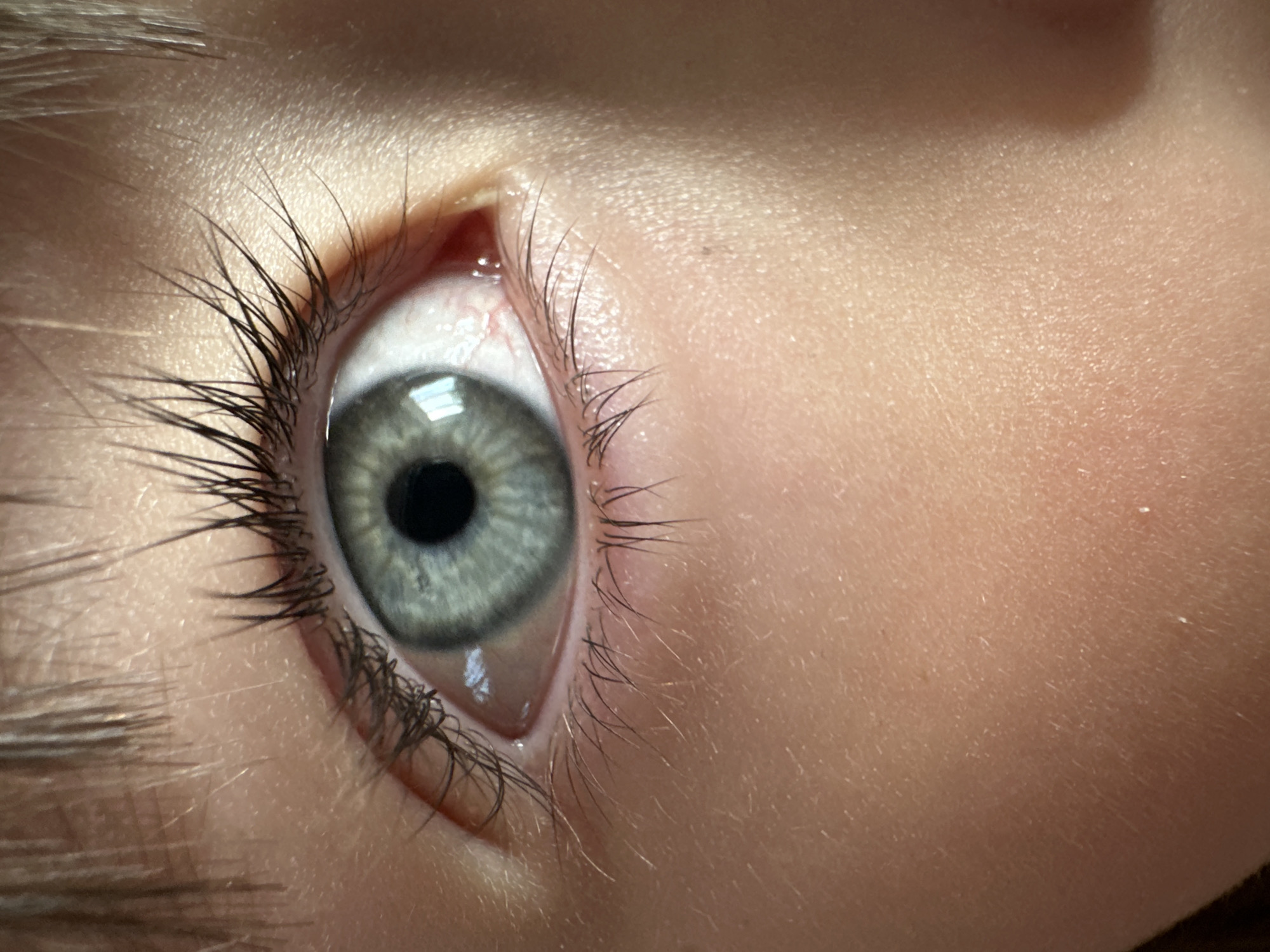 A close-up photograph shows a human eye with long, dark eyelashes. The iris is a light blue-gray color. The surrounding skin appears light-toned with fine hairs. The specific location is not identifiable as Chaikovsky, Russia, based solely on the given image.