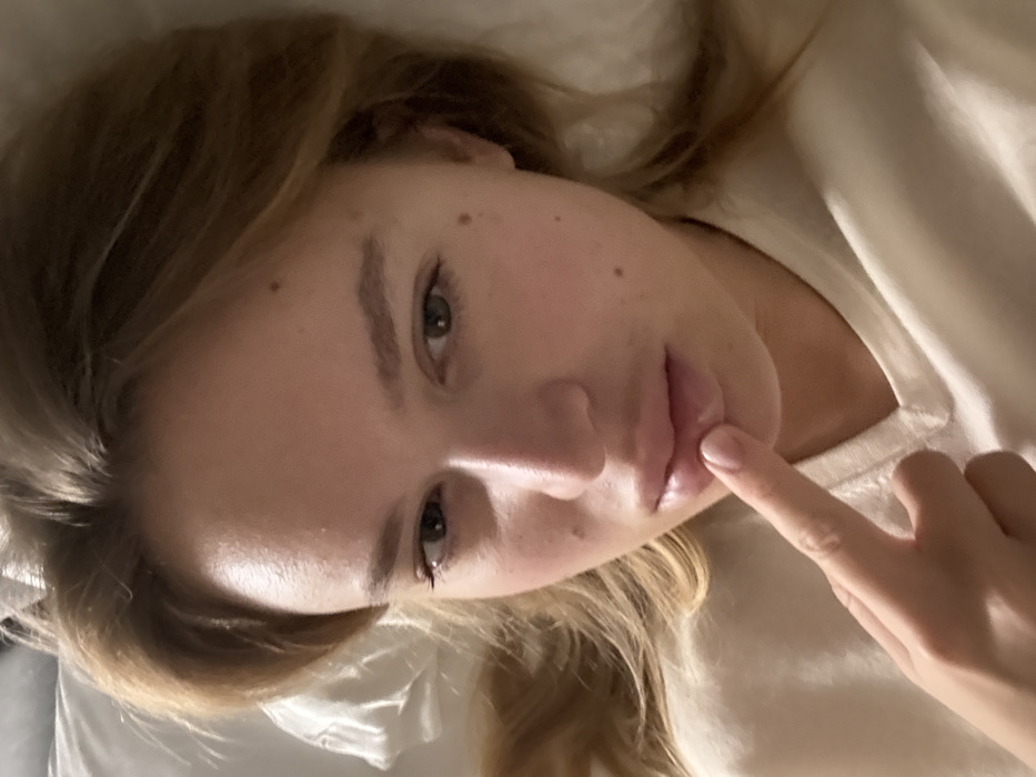 A young woman with fair skin, light brown hair, and light eyes is pictured in a close-up, slightly angled shot. She is wearing a beige top and lying on a white pillow. Her right index finger is touching her upper lip. She has a few moles on her face. The lighting is soft, creating a diffused effect.