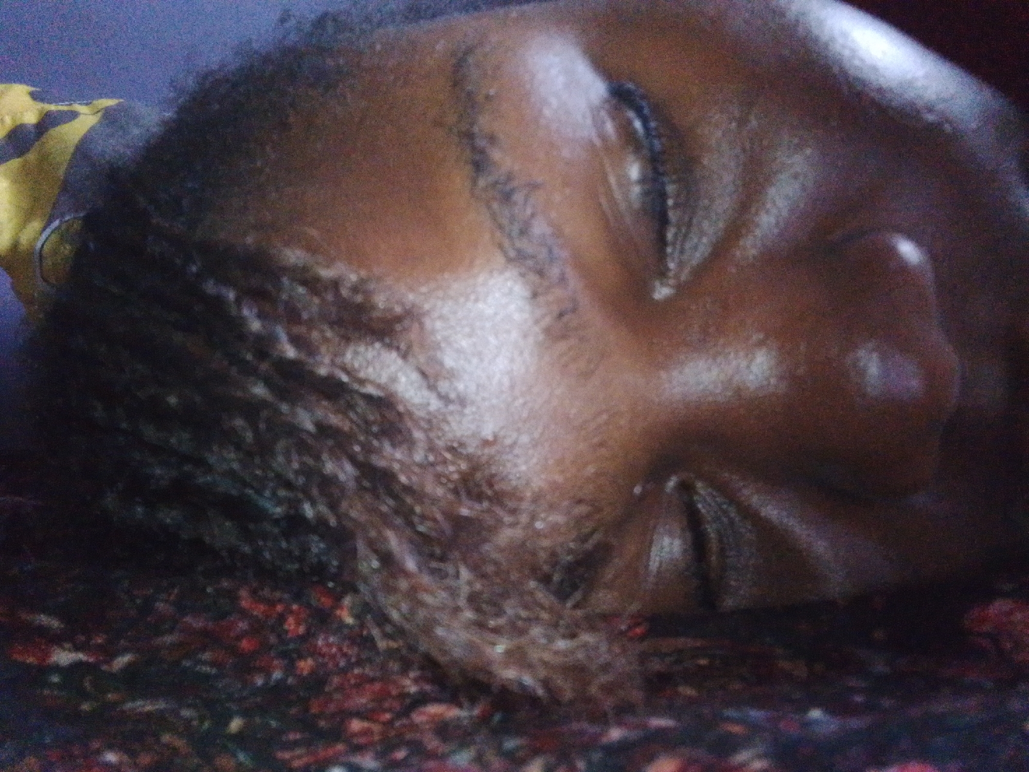 The image is a close-up, angled shot of a person's face, with their eyes closed and head tilted to the right. The person has dark skin and dark hair. The background is dark and appears to be a patterned fabric, possibly a bedsheet or blanket. A portion of yellow and black fabric is visible in the upper left corner. The scene appears to be indoors, likely a residential setting in Nsukka, Nigeria, given the context provided. The image quality is grainy, suggesting it was taken in low light or with a low-resolution camera. The focus is primarily on the facial features and the texture of the skin and hair.
