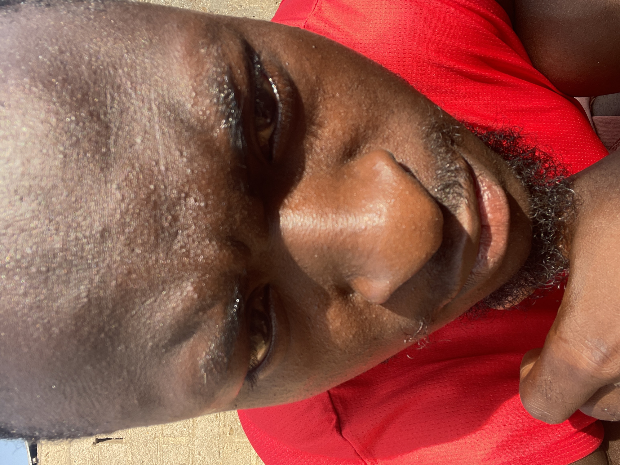 The image is a close-up shot of a dark-skinned person's face, likely male, with noticeable perspiration on the skin. The person is wearing a red shirt. Some stubble is visible on the chin and upper lip. The background is out of focus, but a light-colored surface is present on the left side of the frame. There is no information to suggest that this image was taken in the city of Akwanga, Nigeria.