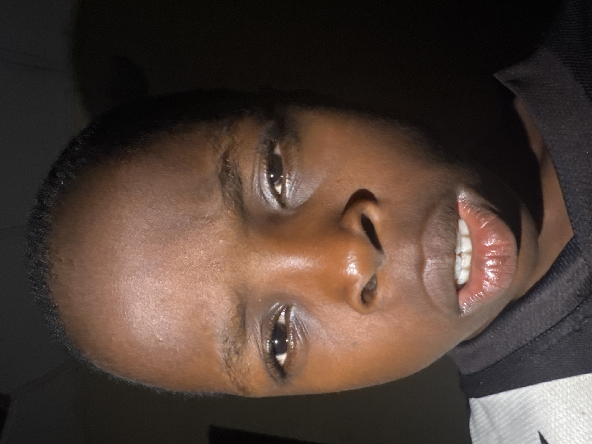 Close-up portrait of a person with dark skin, short dark hair, and brown eyes. The person has full lips and visible teeth. They are wearing a black shirt with white detailing on the shoulder. The background is dark and indistinct. There is no information in the image to indicate that the location is Onitsha, Nigeria.