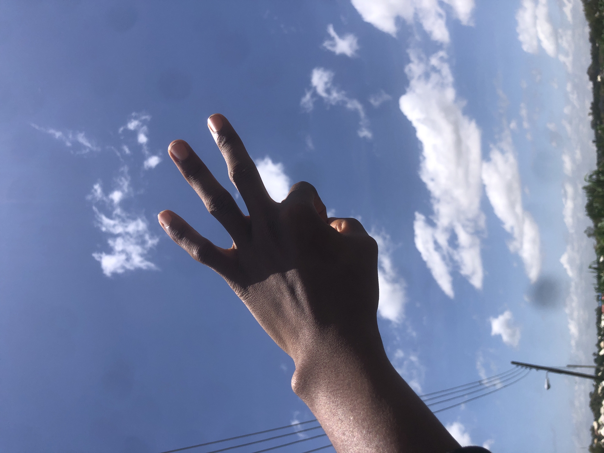 A close-up, low-angle shot captures a dark-skinned hand with three fingers extended against a bright blue sky dotted with white clouds. The hand is positioned on the left side of the frame, with the fingers pointing towards the upper right. The wrist area on the left displays a noticeable bulge, likely a ganglion cyst. In the background, utility poles with thick cables stretch across the sky, and a hazy line of trees and buildings suggests a semi-urban or rural setting. The overall impression is one of a casual gesture or pose against a natural backdrop. The location is the city of Gwafan, Nigeria.