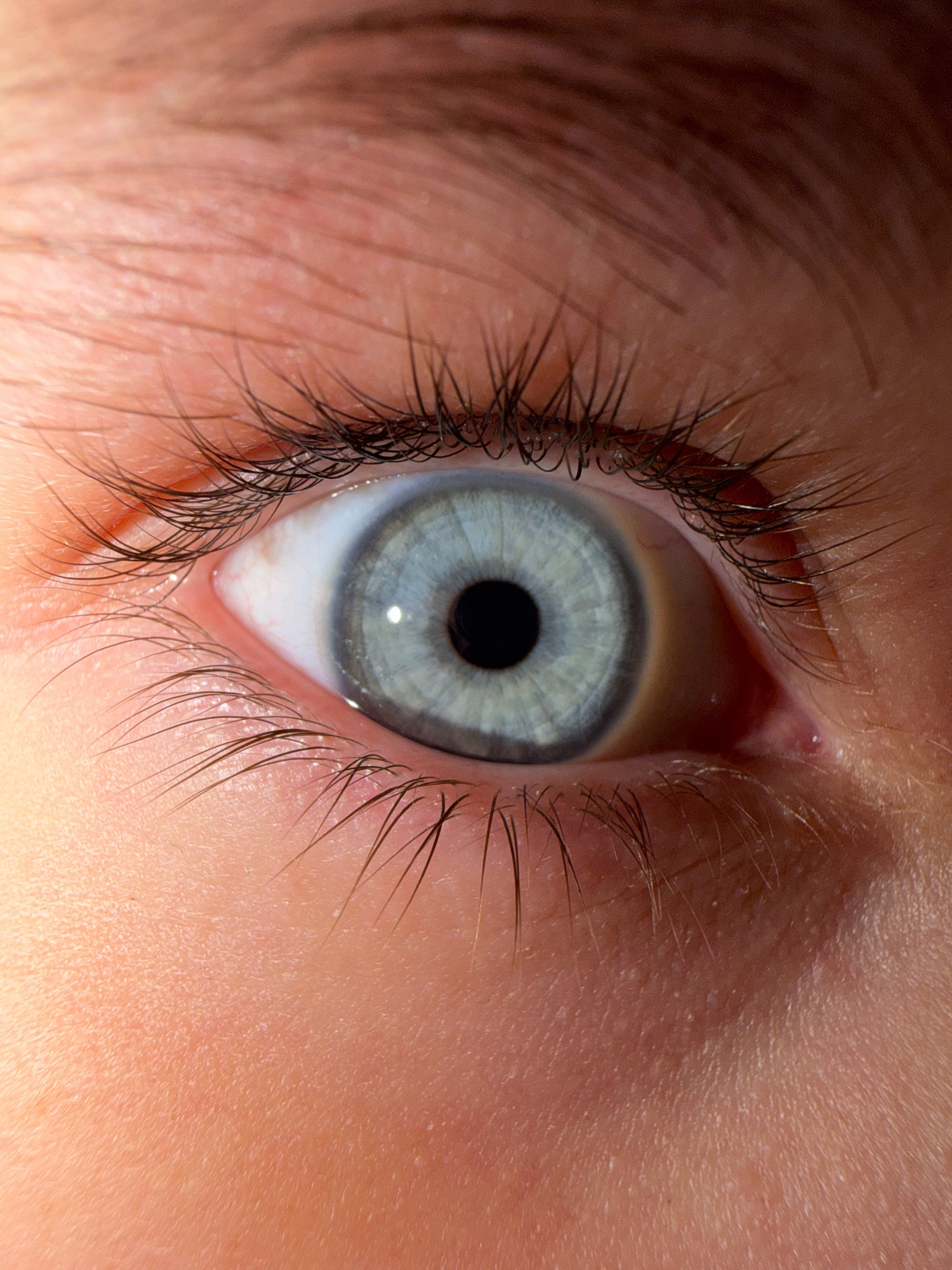 The image is an extreme close-up of a human eye with light blue irises and a black pupil. The surrounding skin is a peachy tone, with visible eyelashes and fine hairs. The lighting suggests a natural light source, possibly sunlight, casting subtle shadows and highlighting the textures of the skin and eye. The image is purely an eye, with no discernible background or environmental context.