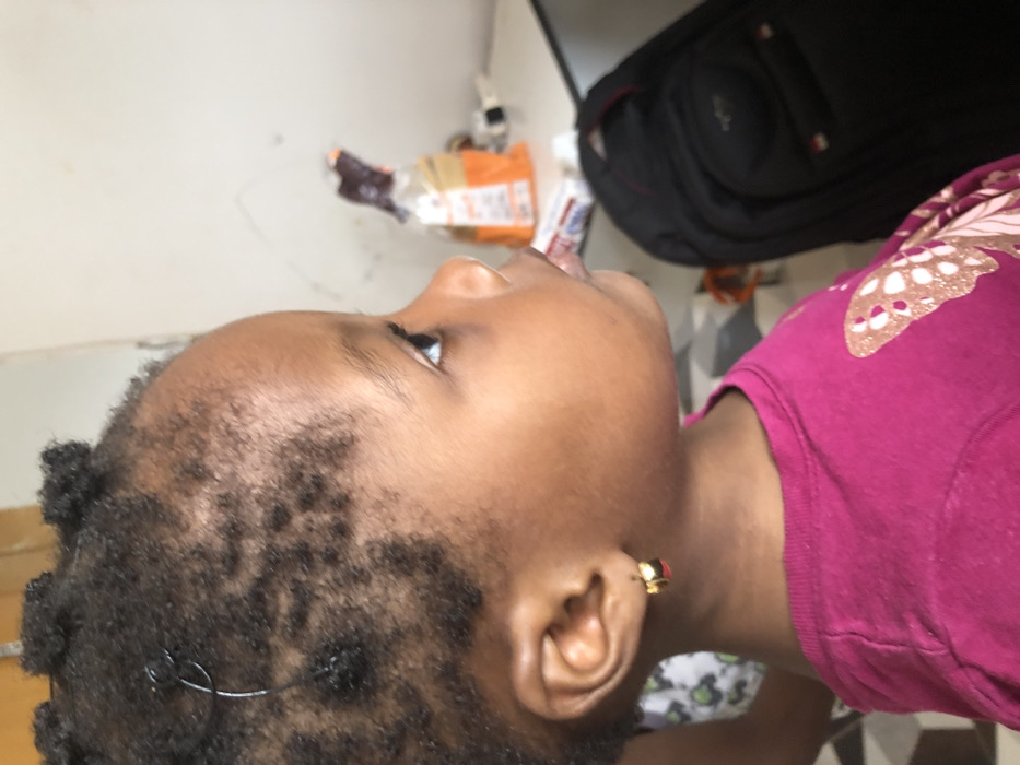 The image depicts a young, dark-skinned child, likely female, in a residential setting in Ilishan, Nigeria. The child is presented in a close-up profile view, facing towards the right with her head slightly elevated and eyes directed upwards. Her dark, short hair is styled in small knots, with a thin dark wire or thread visible in one section above her left temple. She wears a bright pink short-sleeved top adorned with a light-colored butterfly motif on the right chest area. A small, gold-colored hoop earring with a red accent is present in her left earlobe. To the far left, a portion of another individual's limb, dressed in a white garment with dark patterns, is partially visible behind the child. The background consists of a plain, light-colored wall. On a surface in the mid-ground right, a brown and orange package is visible, along with a darker, indistinct object behind it. A black backpack with red accents is located on the lower right side of the frame.