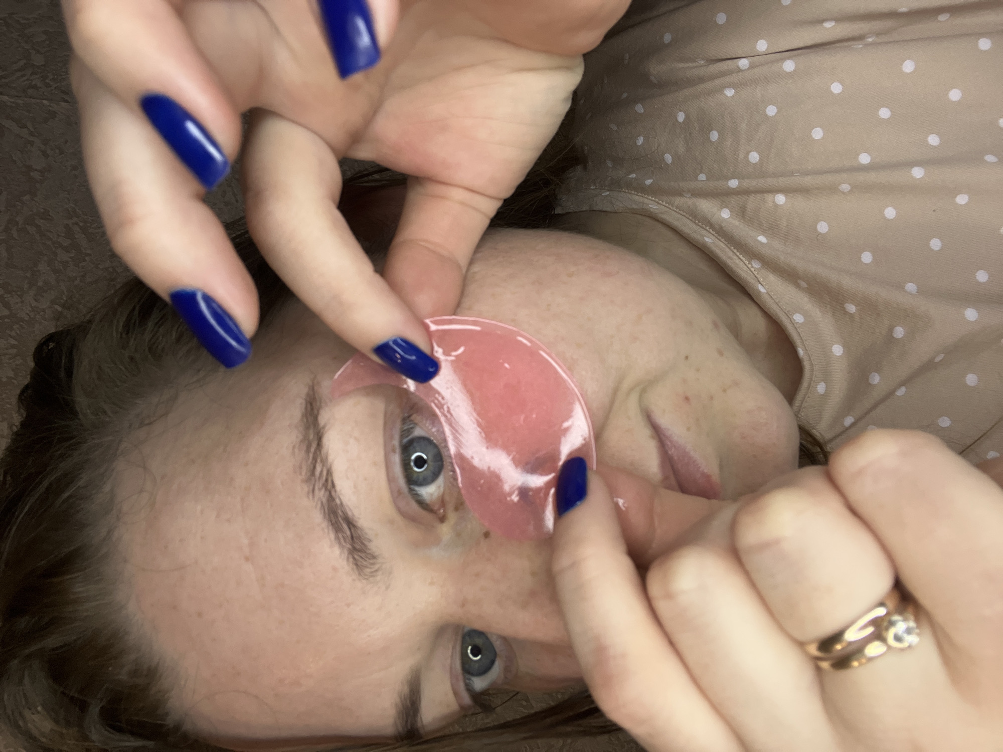 A woman is applying pink eye patches underneath her eyes. She has blue nail polish. She is wearing a beige shirt with white polka dots. A gold ring with a stone is on the ring finger of her right hand. There is no indication of the location being in Раздолье, Russia.