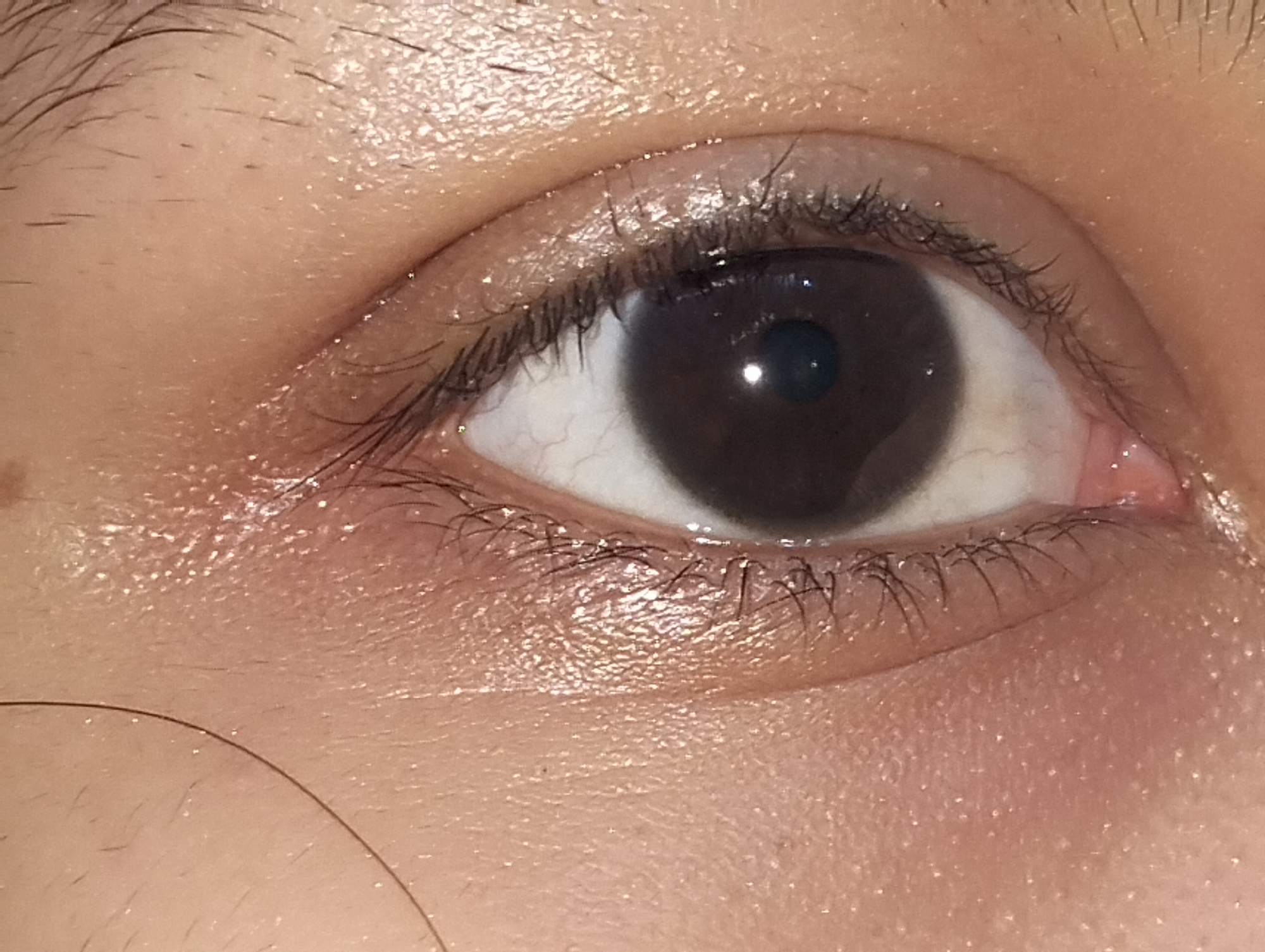 Close-up view of a human eye. The iris is dark brown. Eyelashes are visible on the upper and lower lids. The skin around the eye appears slightly moist and has visible texture. No specific location or city information can be derived from this image. The environment is undefined, and there are no actions, interactions, or subjects beyond the eye itself.