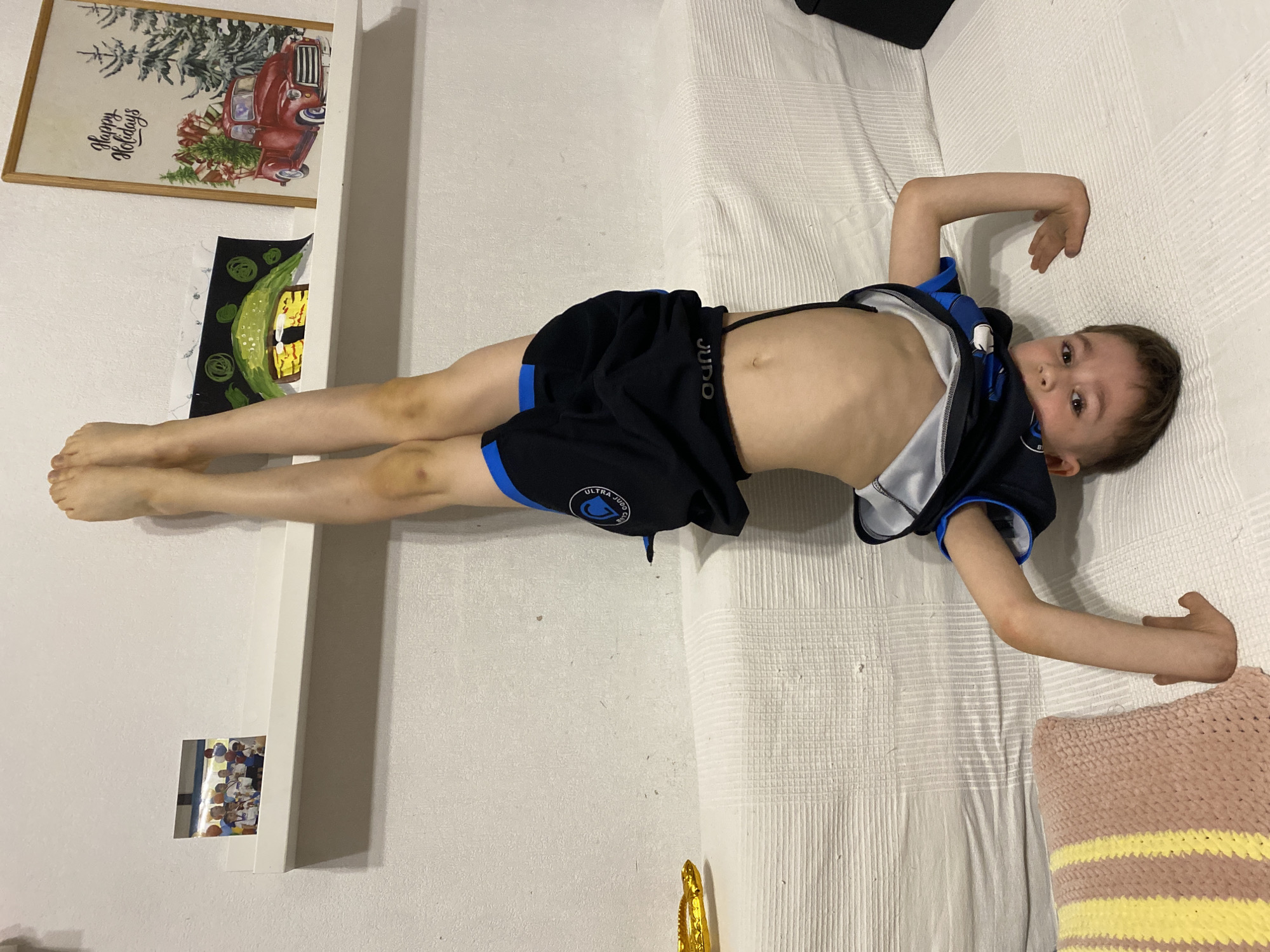 A young boy, appearing to be between 4 and 7 years old, is the central subject of this indoor image taken in Yekaterinburg, Russia. He is lying on his back on a white, textured surface, likely a bed or sofa. He wears a dark blue and black athletic outfit, consisting of shorts and a partial top, with his torso exposed. The shorts feature the text "JUDO" and "ULTRA JUDO" with an accompanying logo. His legs are extended straight upwards, propped against a white vertical surface, possibly a wall or a tall piece of furniture. Faint yellowish and purplish bruises are visible on his knees and shins, common for active children. His arms are bent, with his hands positioned near his head, and he looks directly at the camera with a neutral expression.
The background shows elements of a furnished room. On a shelf or ledge to the boy's left, an unframed picture displays a red vintage truck in a snowy landscape, adorned with Christmas trees and gifts, and bears the text "Happy Holidays". Below this, a vibrant, abstract drawing with green and yellow patterns on a dark background is displayed. Further down, a smaller framed photograph, whose contents are indistinct but appear to show a group of people, is visible. To the right of the boy, a pink and yellow striped knit pillow is partially in view. A golden decorative object rests on a surface near the bottom center of the frame. The lighting in the room is even, suggesting artificial light sources.