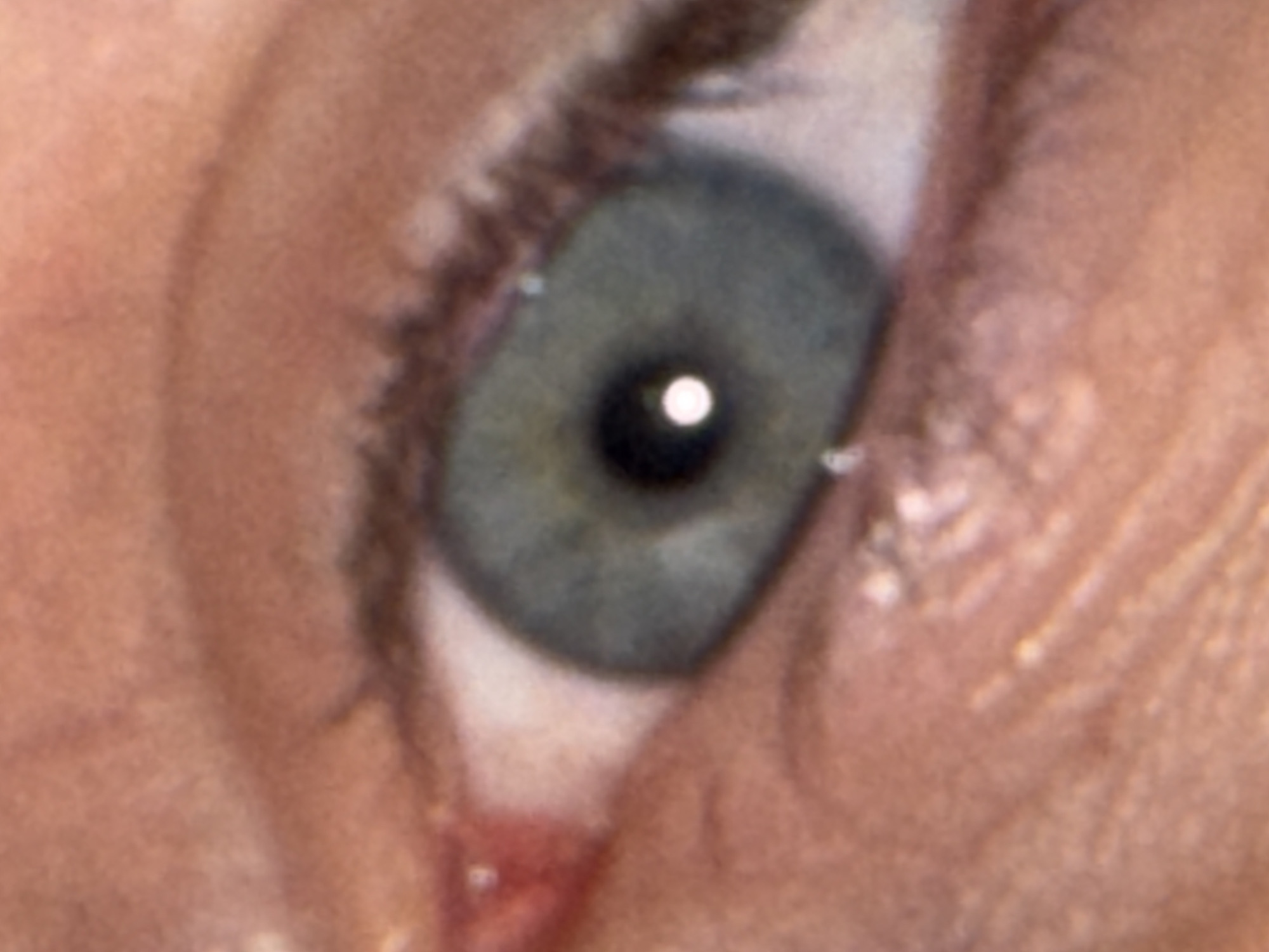 A close-up image shows a human eye. The iris is a shade of gray-green. A white specular reflection is visible in the pupil. The surrounding skin is pale and displays texture. The lower eyelid appears slightly inflamed. The image does not show any information related to the city of Perm, Russia.