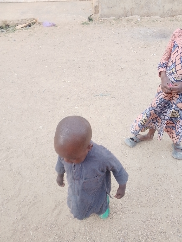 A child in a loose-fitting, gray garment stands on a tan, dusty ground. The child looks down, with a bald head visible. Part of another child wearing a patterned dress and gray shoes is to the right, standing still. The backdrop includes a building structure and scattered debris on the ground. The scene suggests an outdoor, possibly rural, environment.
