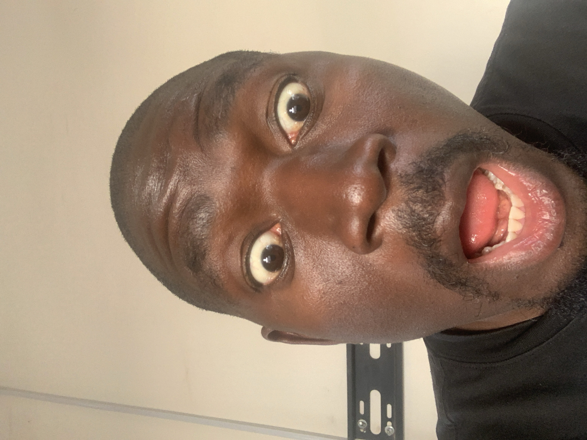 A close-up, head-on view of a dark-skinned man with a shaved head, wide eyes, and open mouth. He has a beard and is wearing a black t-shirt. The background is a plain wall. A black metal bracket with screws is visible near his ear. There is no indication this photo was taken in Jos, Nigeria.