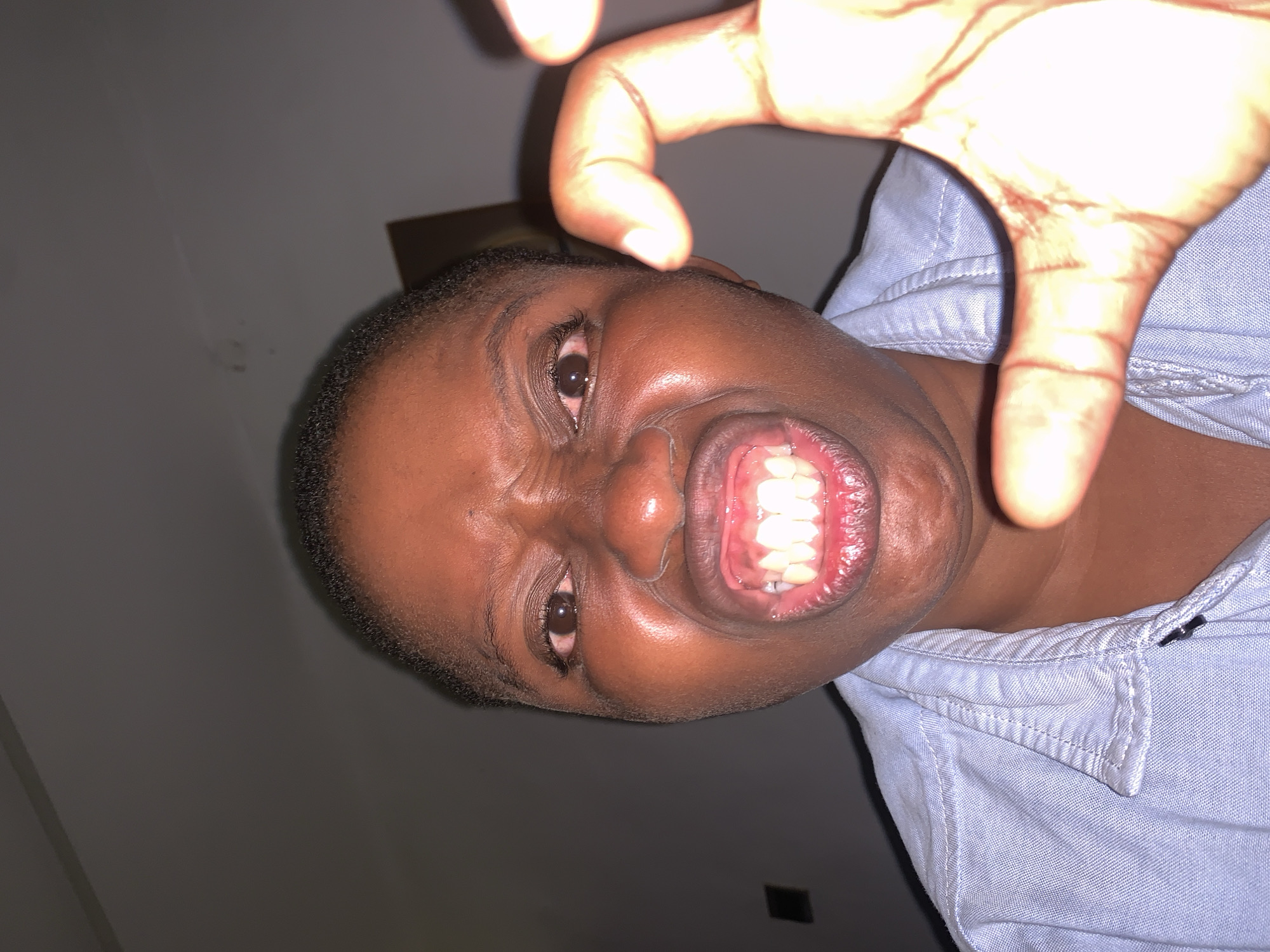 A person is shown from a low angle, close-up view, with their face angled slightly to the left. The person has dark skin, short dark hair, and visible teeth. Their mouth is open in a snarl. One hand is positioned above their head. The person wears a light blue collared shirt. The background is dark, suggesting an indoor location. No specific details indicate a location in Ikorodu, Nigeria.