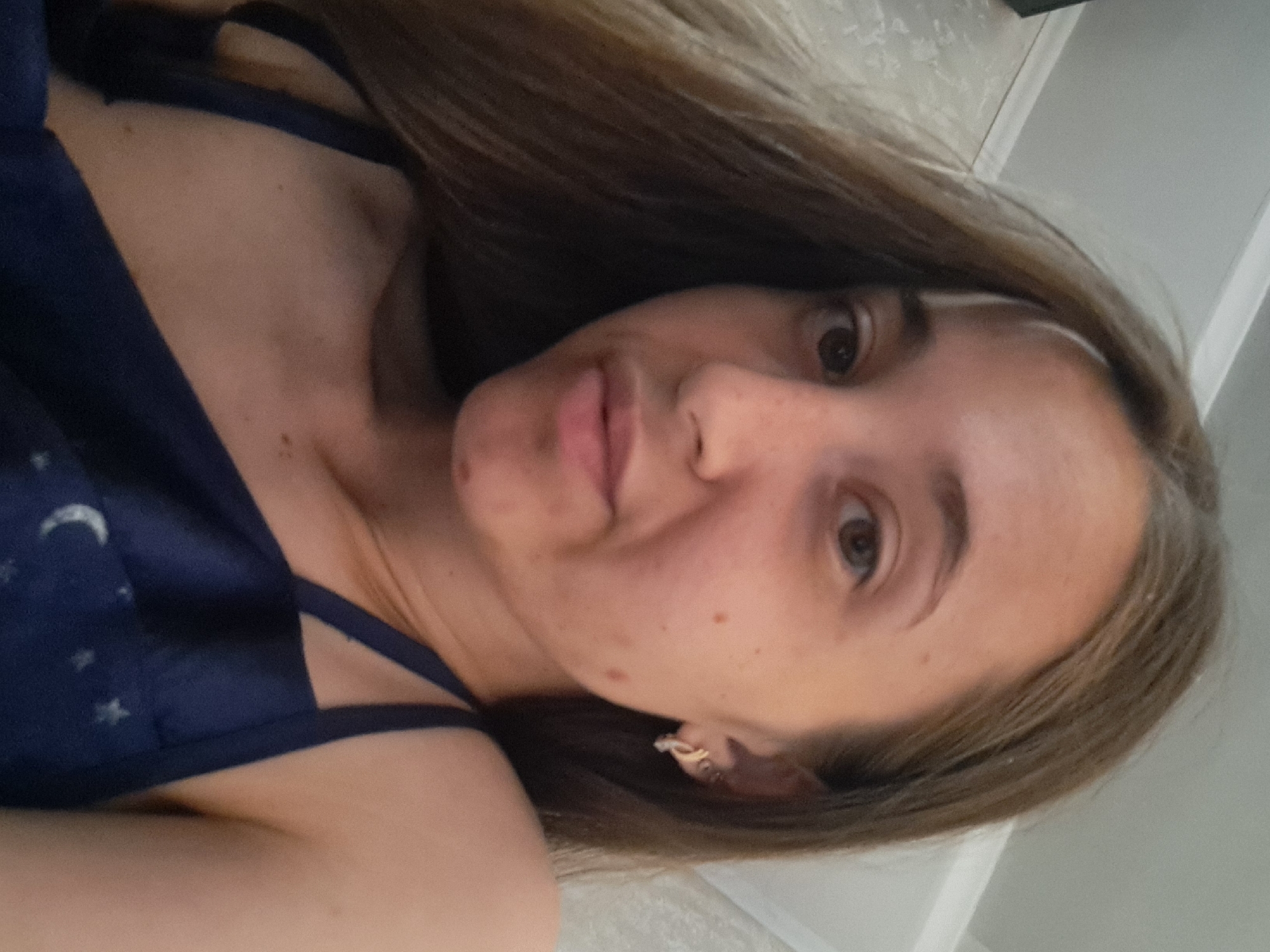 A young woman with long, brown hair, and a prominent white streak near her forehead, is shown in a close-up selfie. She is wearing a dark blue camisole with a celestial pattern of moons and stars. Her skin appears to have a few blemishes and moles, including one on her left cheek and another on her chin. She is wearing a small, gold-colored earring in her left ear. The background is blurry, but suggests an indoor setting with a light-colored wall and possibly a ceiling. There is no indication of the location being in Vypasne, Ukraine.
