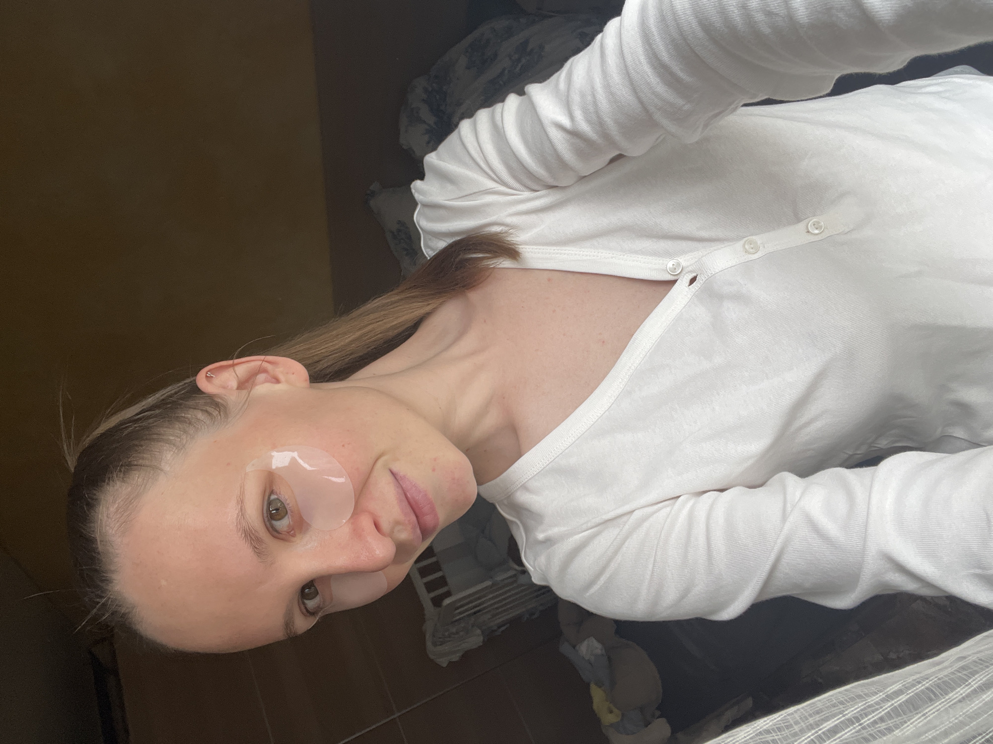 A woman with light brown hair is pictured, wearing a white, long-sleeved, button-down shirt. She has a transparent eye patch under her left eye. The background appears to be a room with a wooden floor and a bed with patterned pillows and blankets. There is a dark-colored wall or cabinet behind her. The location in Khimki, Russia, cannot be determined from the image.