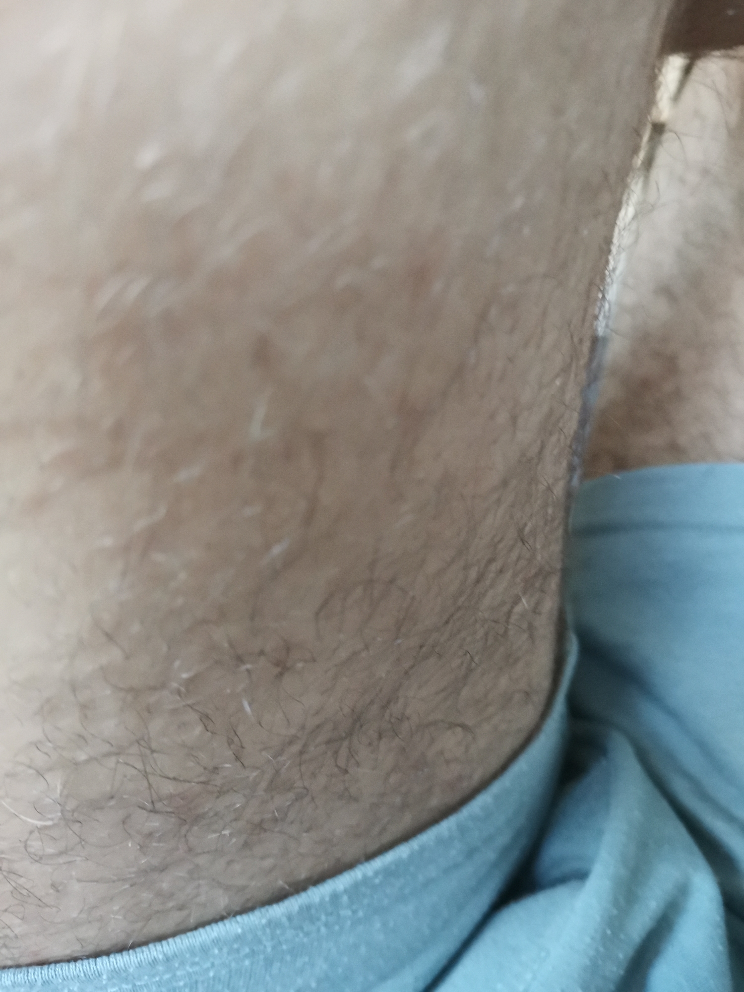 The image displays a close-up, angled view of a human body section, likely the upper thigh or lower abdomen, from the waistline downwards. The skin is a light to medium tone and is largely covered with body hair. The hair density varies, with lighter, finer vellus hairs scattered across the upper and central areas, and darker, thicker terminal hairs more concentrated towards the bottom and right side of the frame. A distinct crease or shadow line runs vertically along the right side, separating the haired skin from an indistinct, darker area beyond. In the lower right quadrant, a band of light blue fabric, consistent with an elastic waistband or hem of an undergarment or clothing article, is visible. The fabric shows some texture and minor surface irregularities. The overall lighting is soft and diffused, providing no environmental context beyond the subject itself. The scene is located in the city of Pokrovnik, Bulgaria.