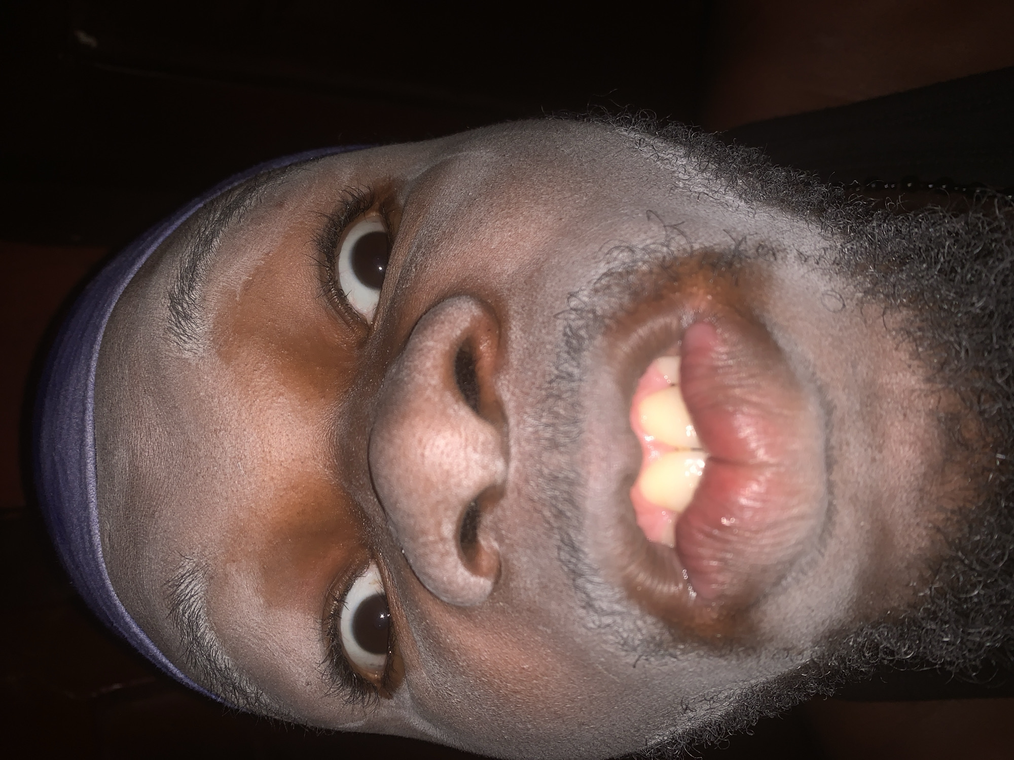 A close-up, rotated portrait shows the face of a person, likely male, with dark skin and a short beard or stubble. The image is captured from a low angle, looking upwards towards the subject's face, which is oriented sideways. The person wears a purple-blue head covering, possibly a durag, pulled back from the forehead. Both eyes are wide open, with the whites clearly visible, and appear to be looking upwards relative to the rotated frame. The nose is prominent, and the mouth is open, revealing moist, full lips, white teeth, and a glimpse of the tongue. The expression appears animated, perhaps surprised or playful. The lighting suggests a flash was used in a dark setting, illuminating the face brightly against an indistinct, dark background. No specific location details are discernible from the image itself, but the context indicates Onitsha, Nigeria. There is no visible text.